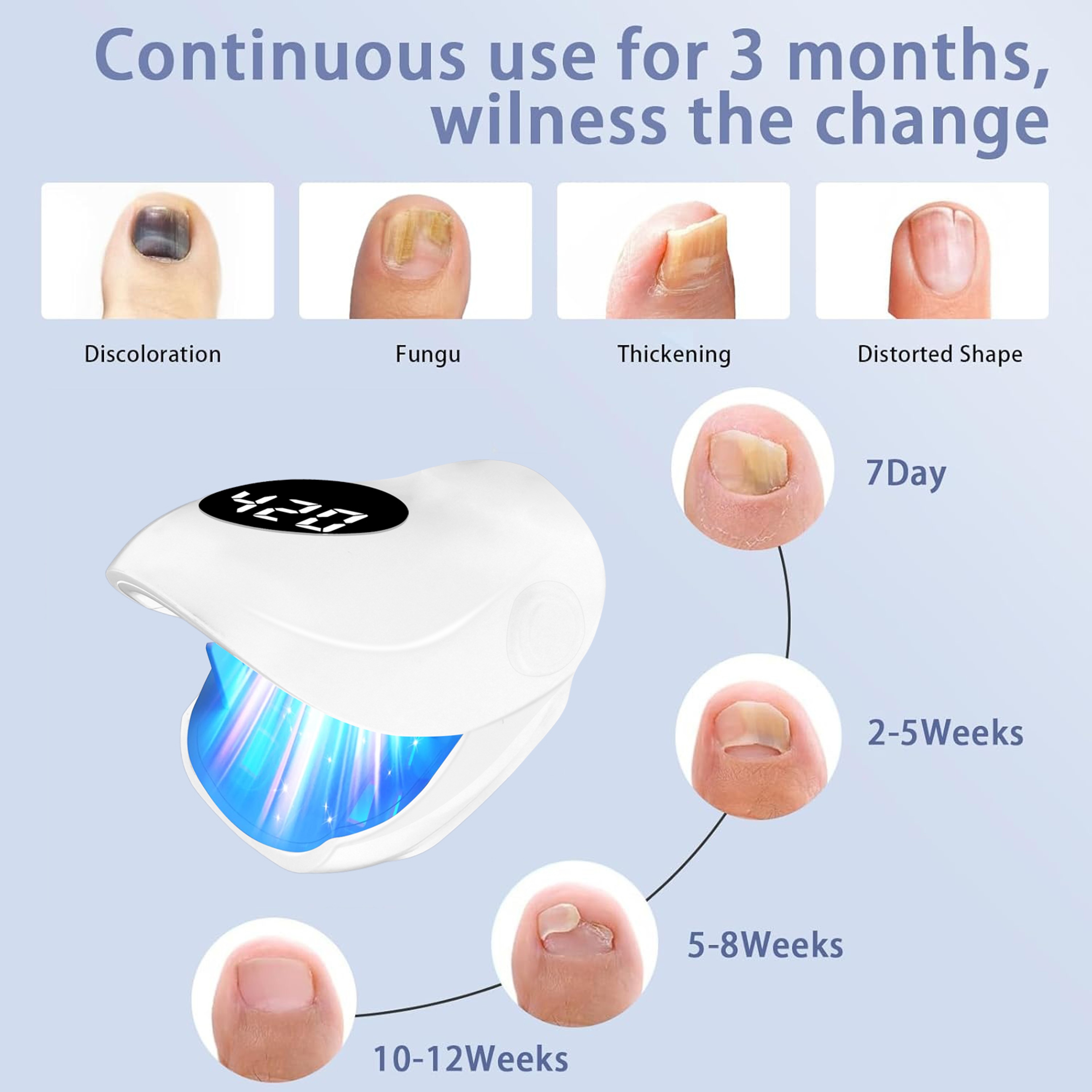 LumiNail Pro LED Nail Fungus Treatment Device with Blue Light & Infrared Therapy – view 3