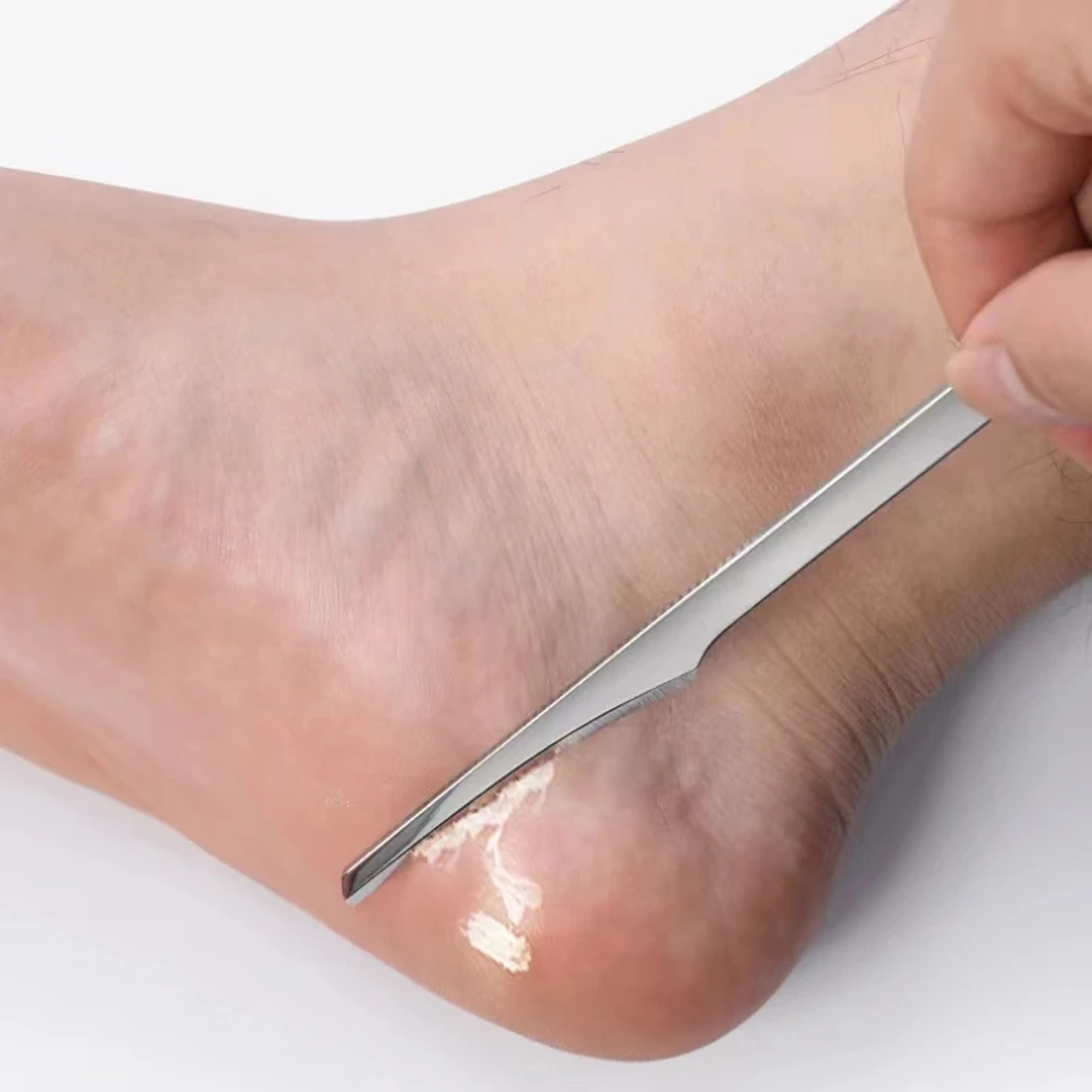 Professional Foot Callus Remover Pedicure Kit With Dead Skin Scraper And Precision Toenail Shaver 0