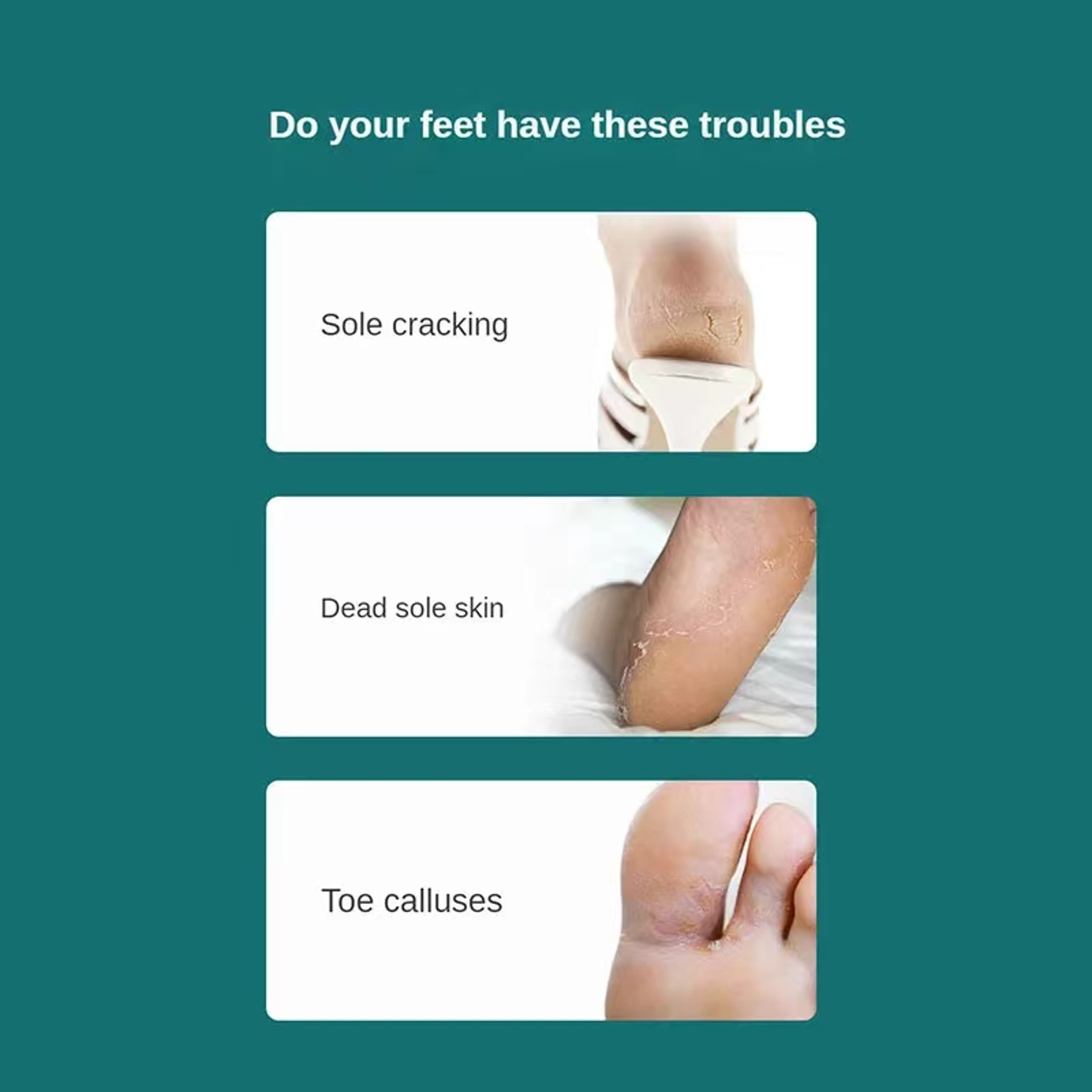 Professional Foot Callus Remover Pedicure Kit With Dead Skin Scraper And Precision Toenail Shaver 3