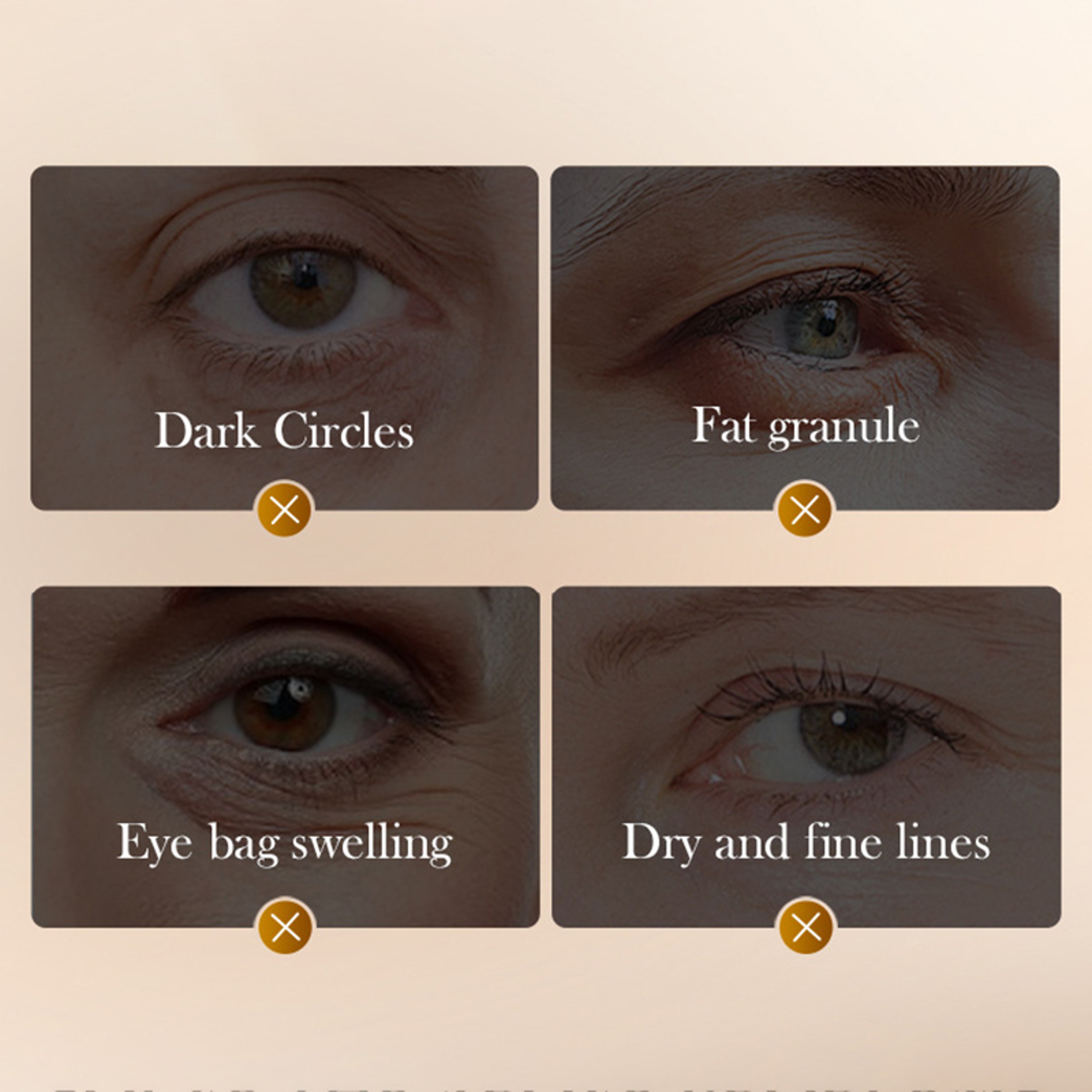 Anti Aging Snake Venom Peptide Caffeine Eye Cream Anti Wrinkle Dark Circles Care 2