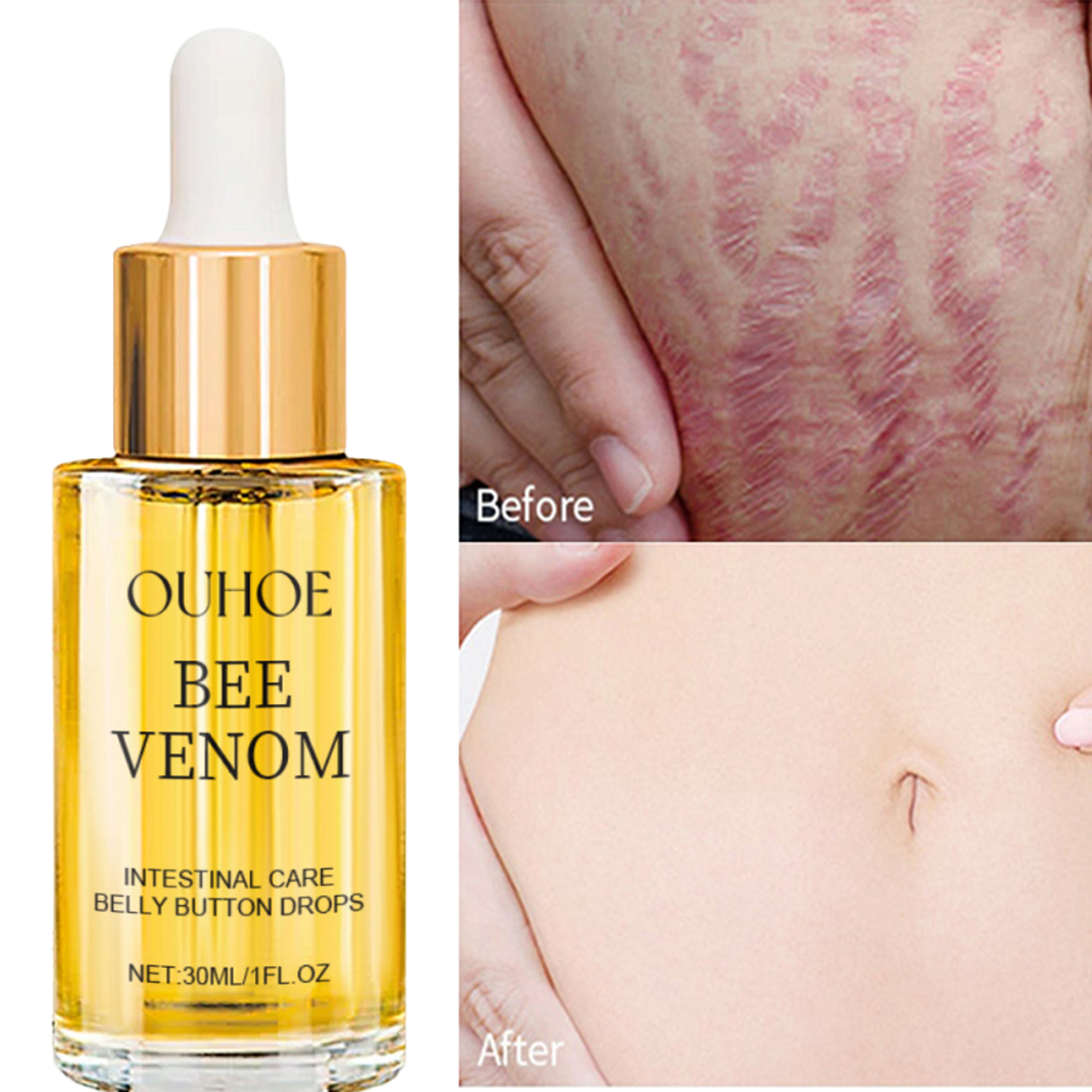 Postpartum Repair Essential Oil Fade Stretch Marks Fat Lines Big Belly Recovery Body Massage Oil Sk