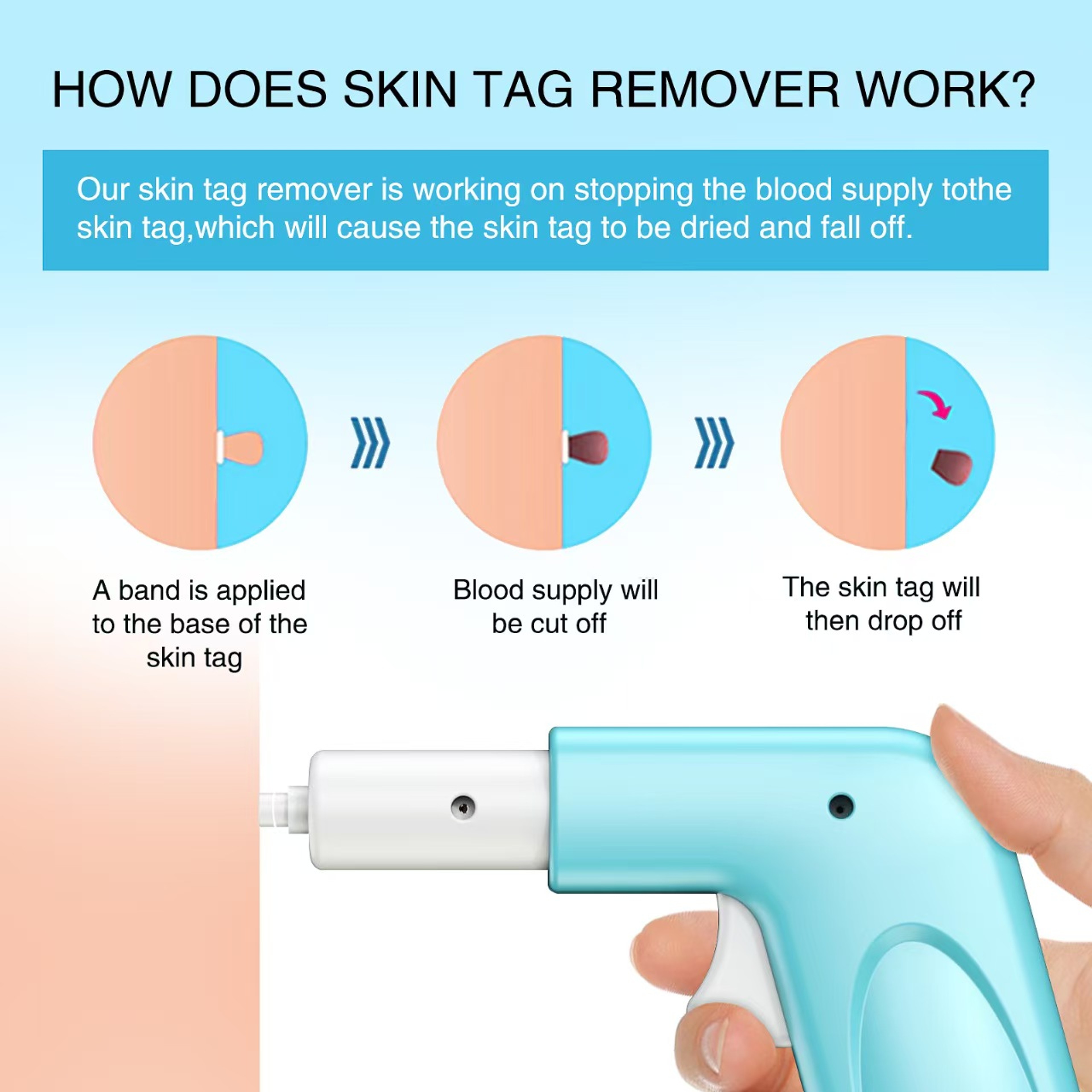 Painless Skin Tag Removal Kit, Safe, Fast & Non-Invasive Solution for Moles & Warts at Home – view 3