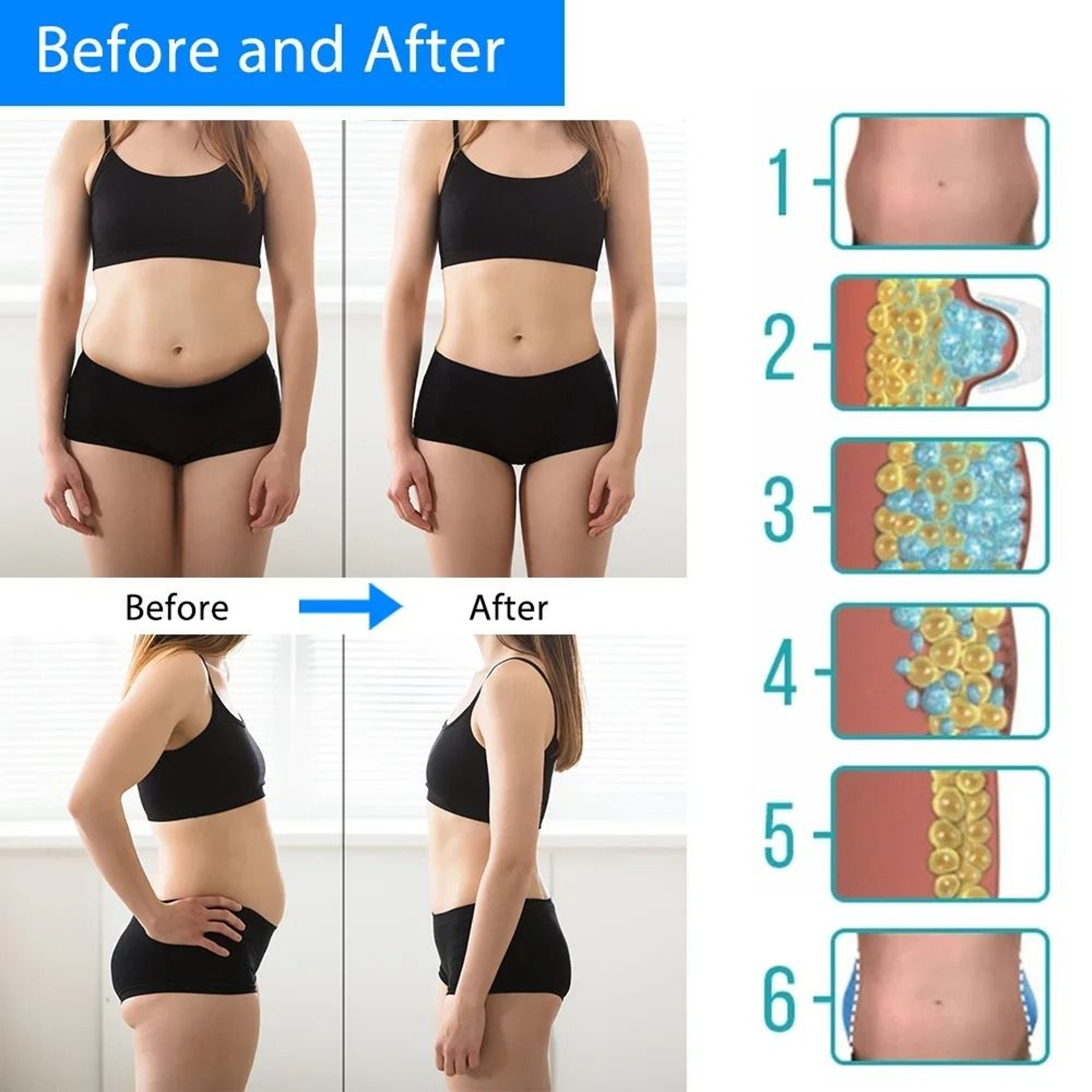 Cryotherapy Fat Freezing Slimming Machine For Abdominal And Body Sculpting 4
