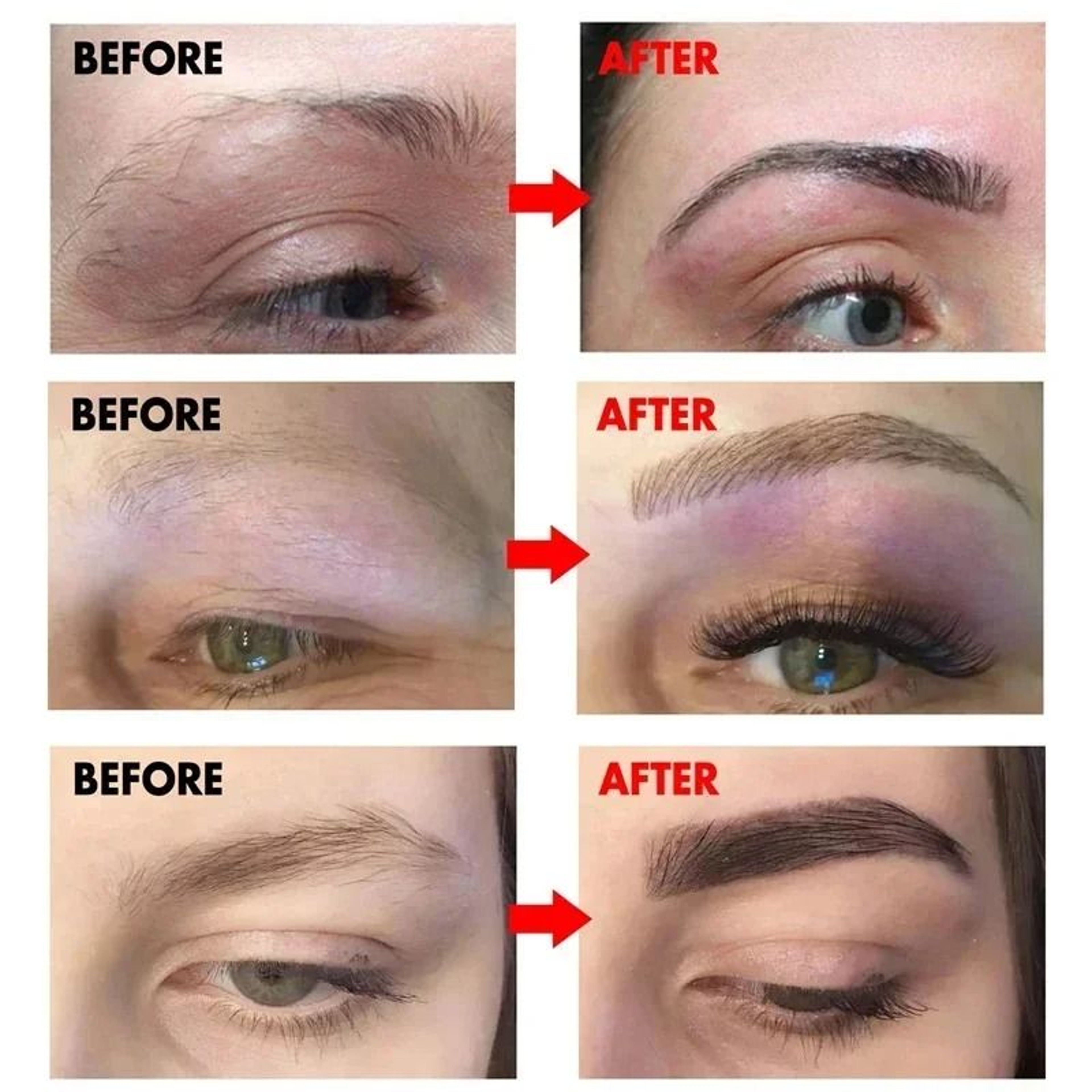 Eyebrow Growth Serum Fast Hair Growth And Thickening Treatment 1