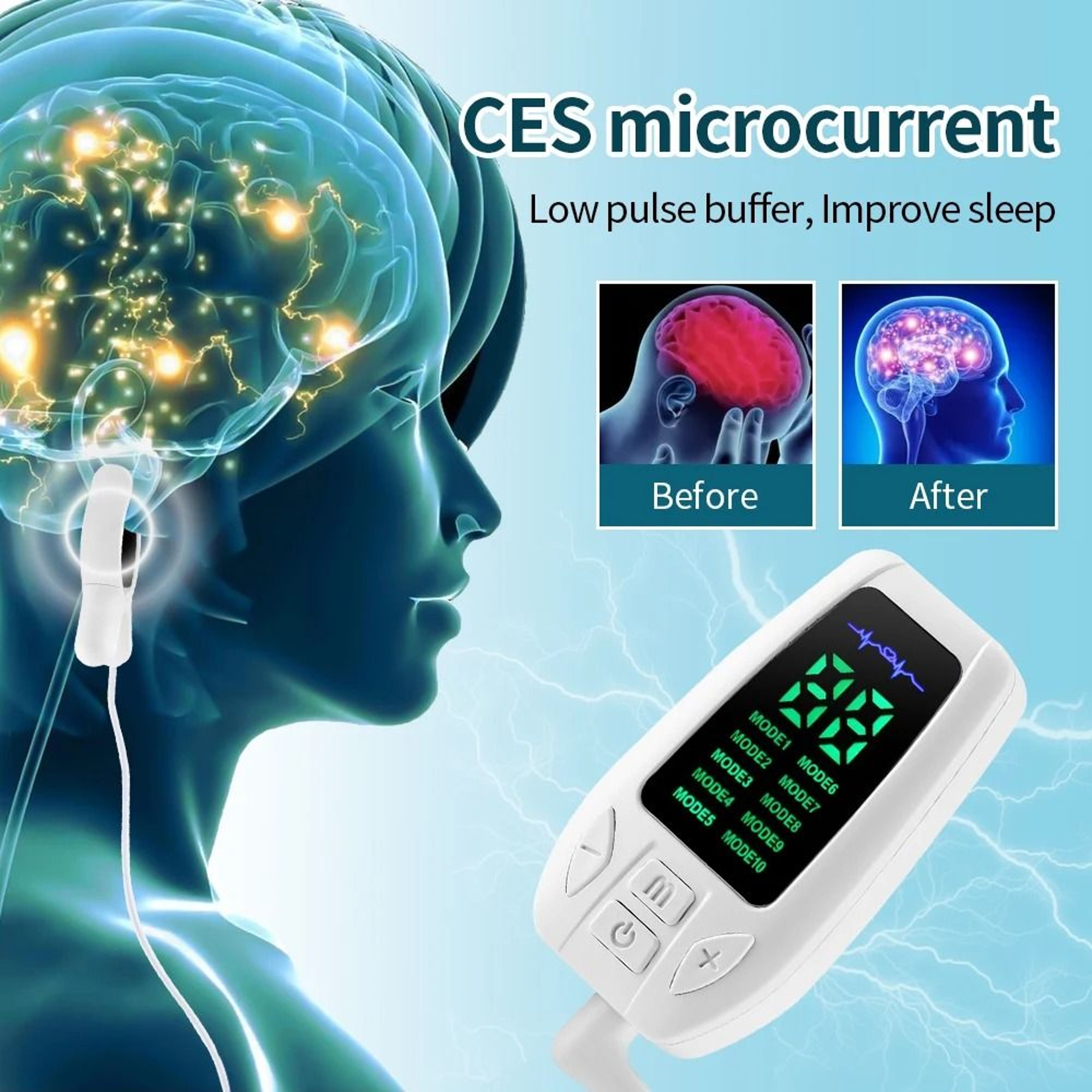 Microcurrent CES Sleep Aid Device With 3 And 10 Modes For Anxiety Insomnia And Relaxation 0
