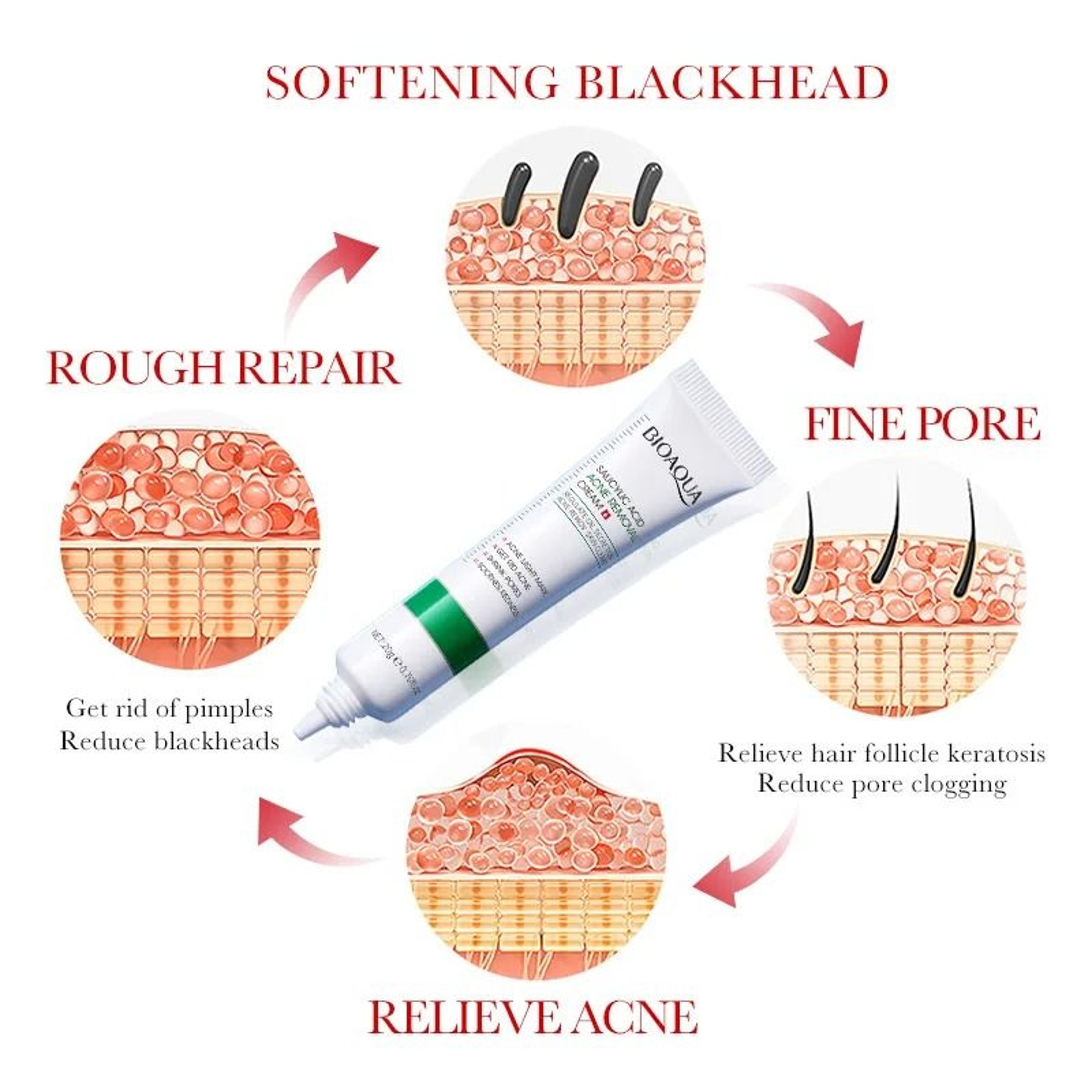 Salicylic Acid Face Cream For Acne Mark Repair And Blackhead Removal 3