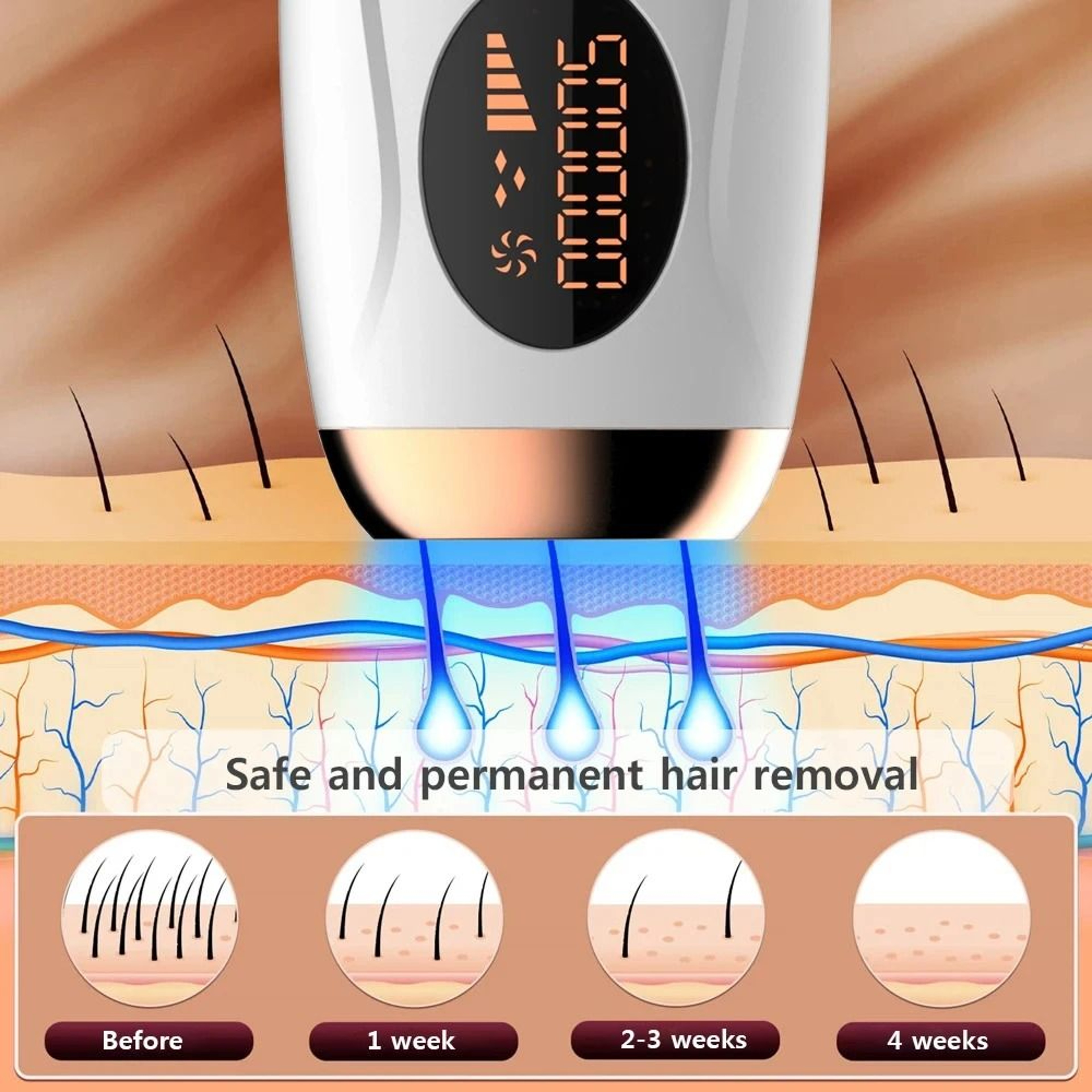 IPL Hair Removal Device For Women With 990000 Flashes And 5 Energy Levels 5