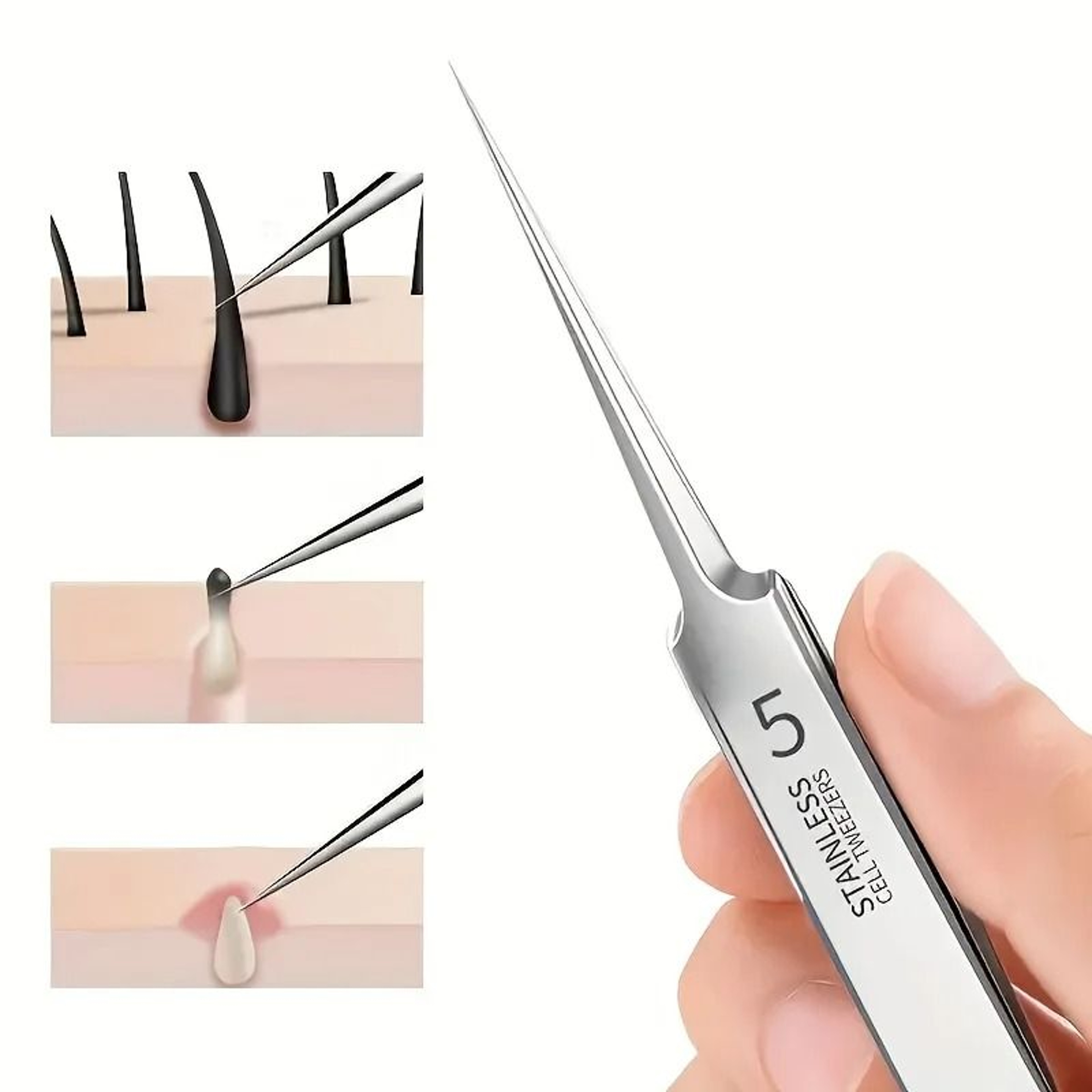 Stainless Steel Tweezers For Powerful Blackhead Removal  Professional Skincare Tool 1