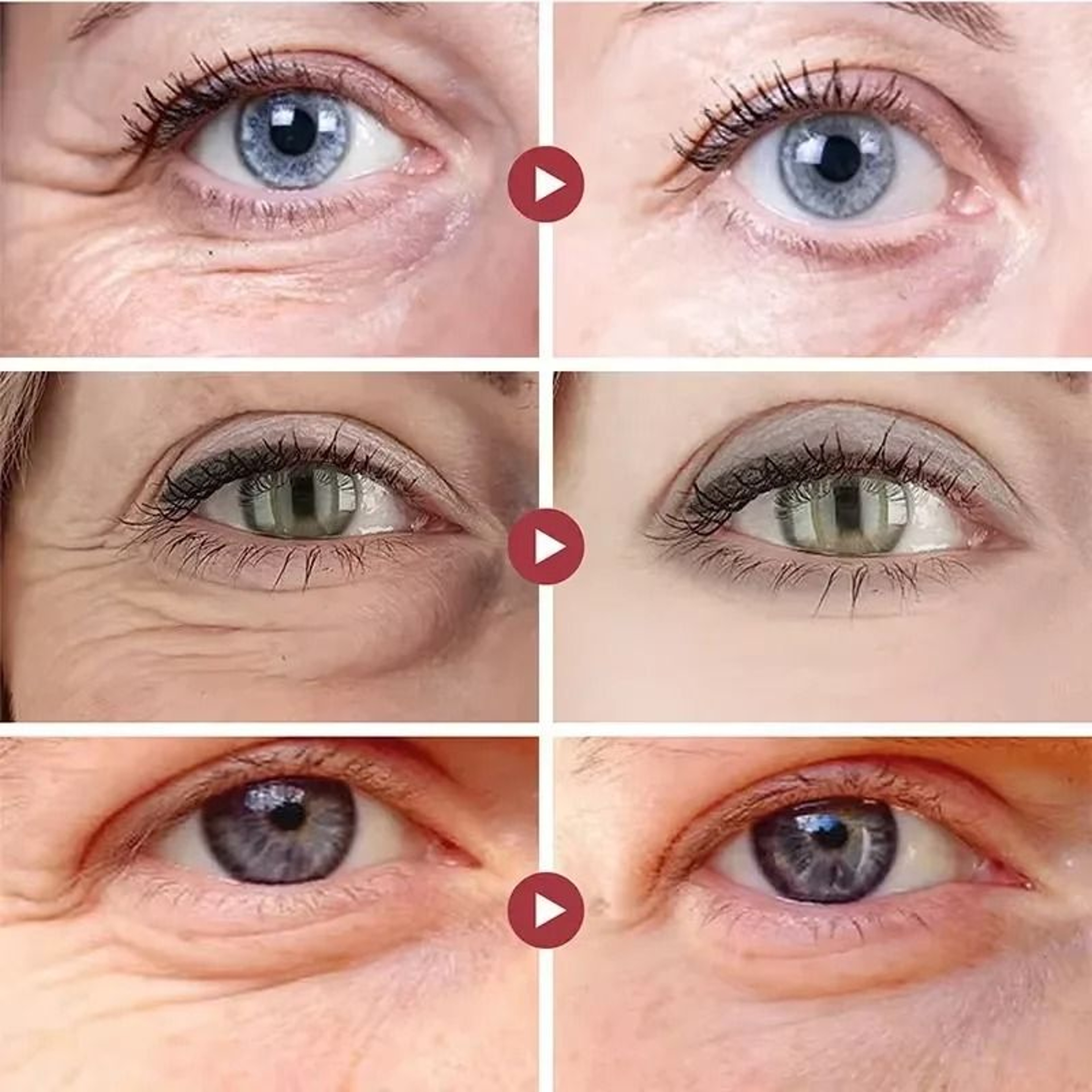 Retinol YouthRenewal Eye Cream  Intensive AntiAging  Fine Line Repair 2