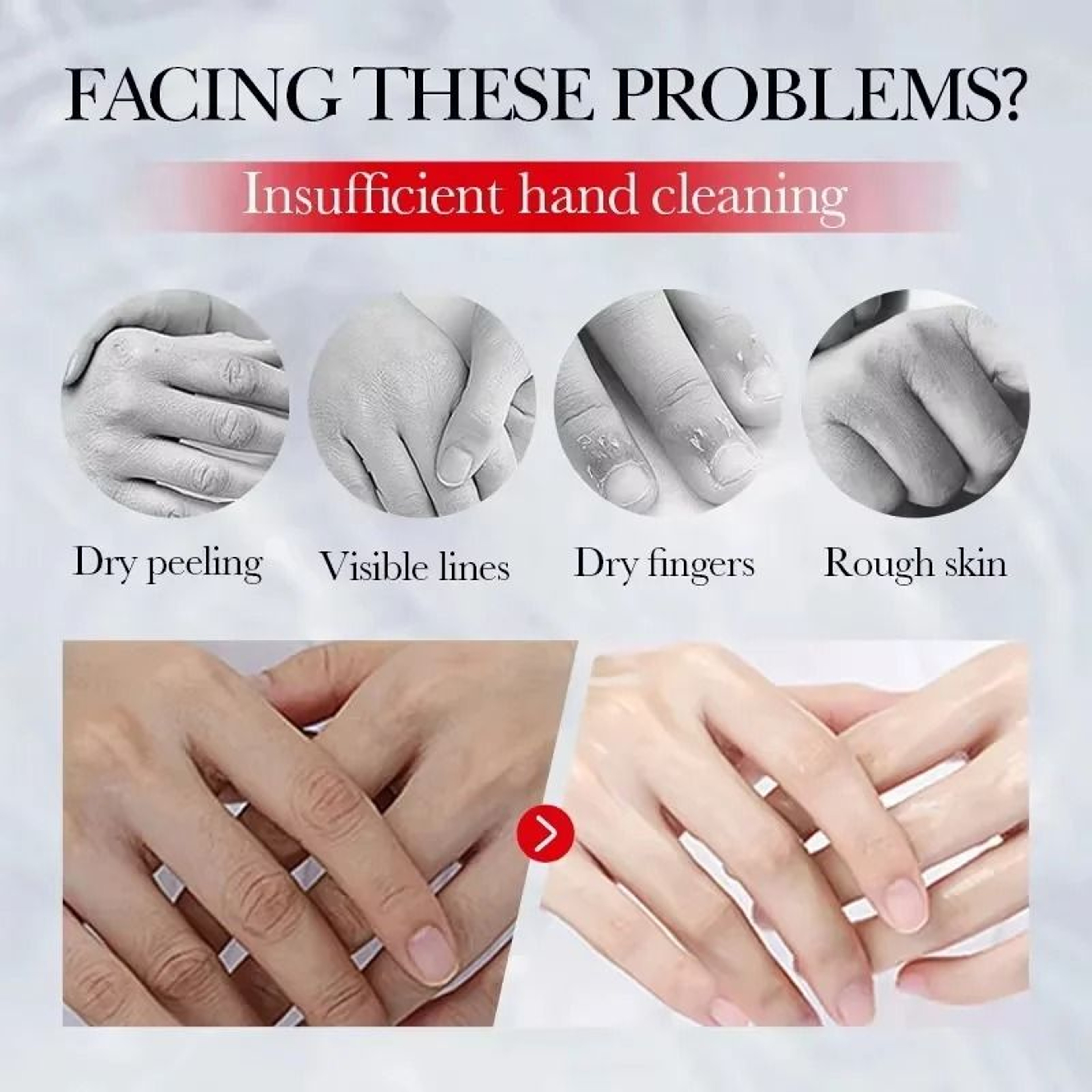 Coconut AntiWrinkle Hand Therapy  Intensive Whitening  Repair Cream 1