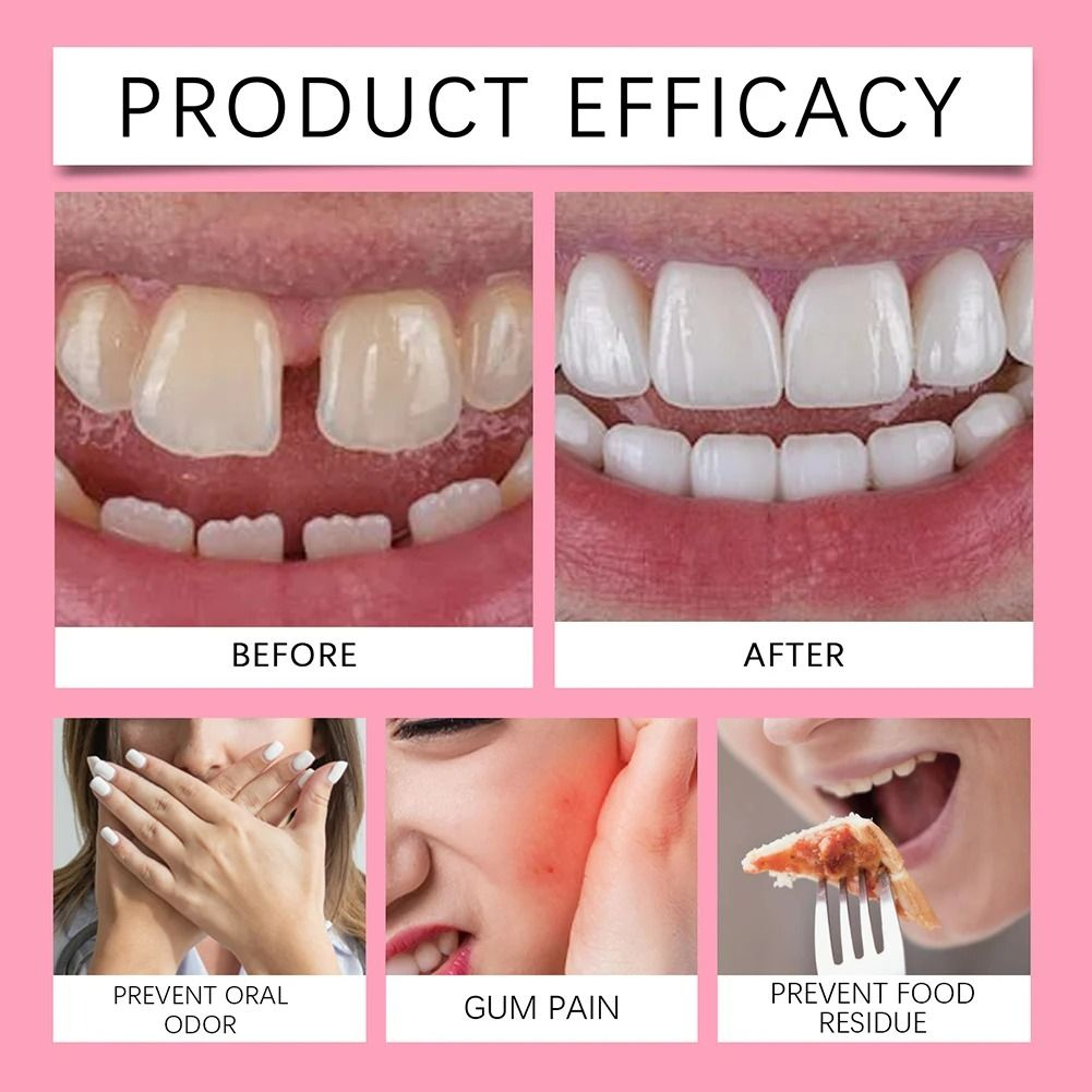 Thermoplastic Denture Fixing Solid Glue 3