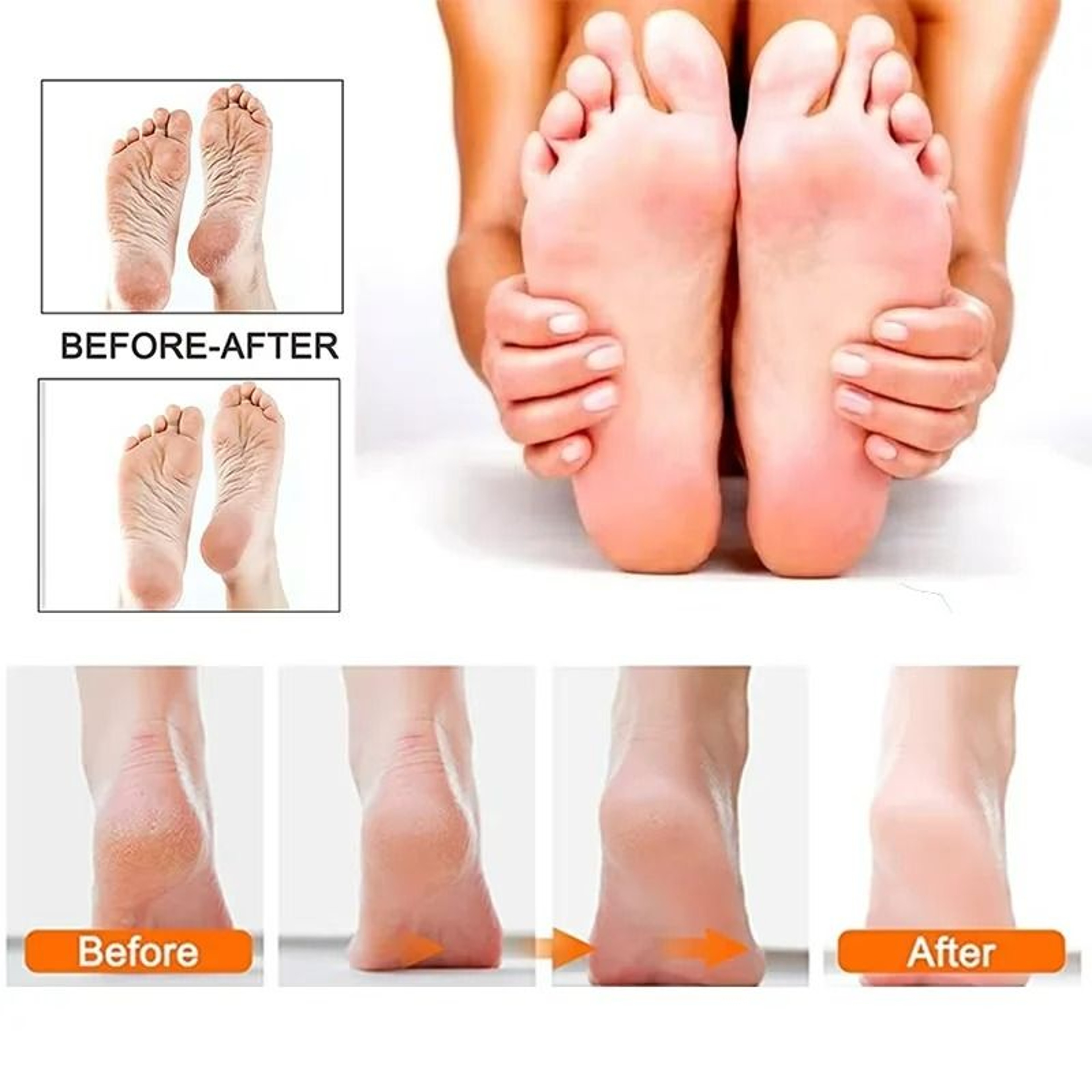 Rechargeable Electric Foot File And Callus Remover 5