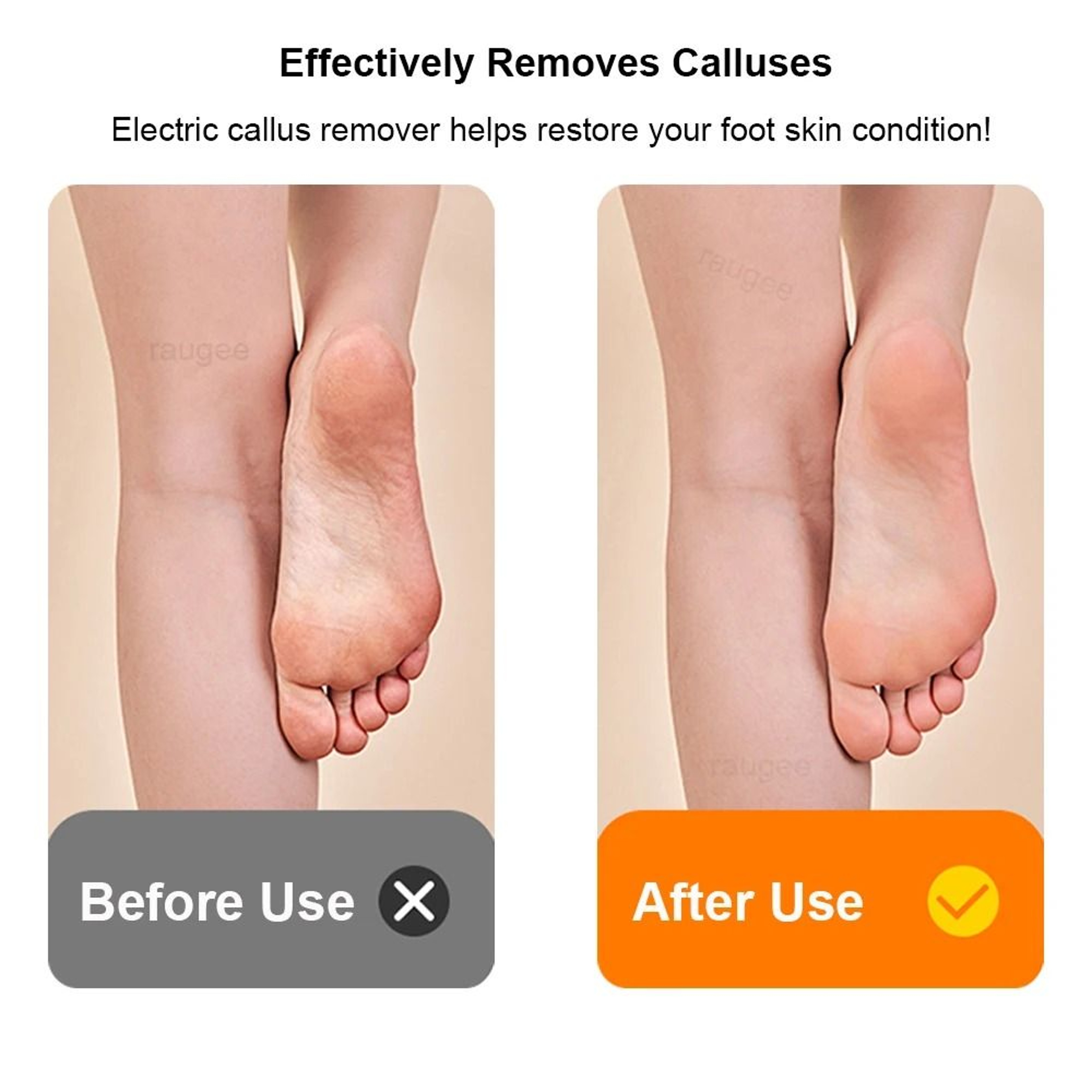 Electric Rechargeable Foot Callus Remover 6