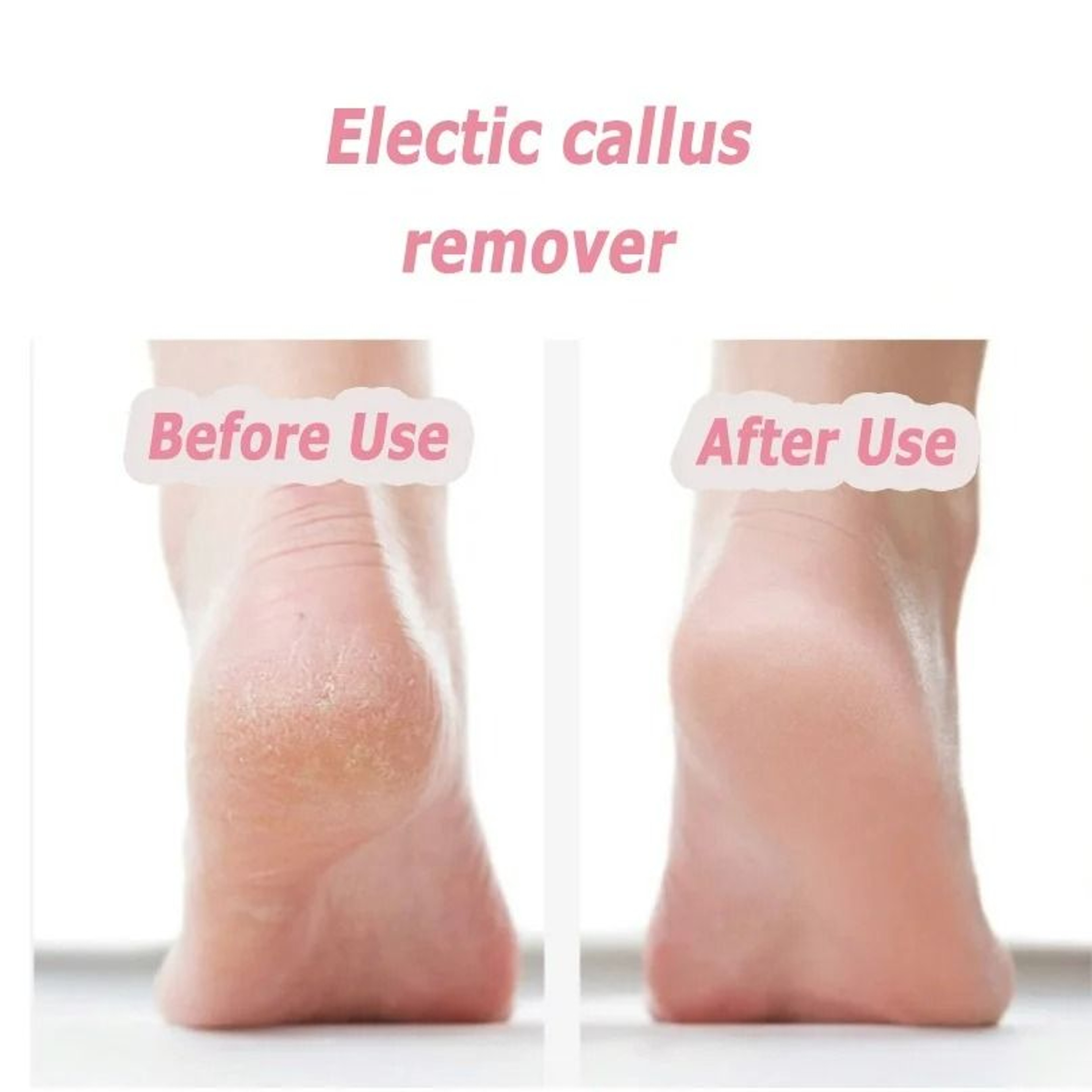 Portable Electric Foot Care Pedicure Set 2