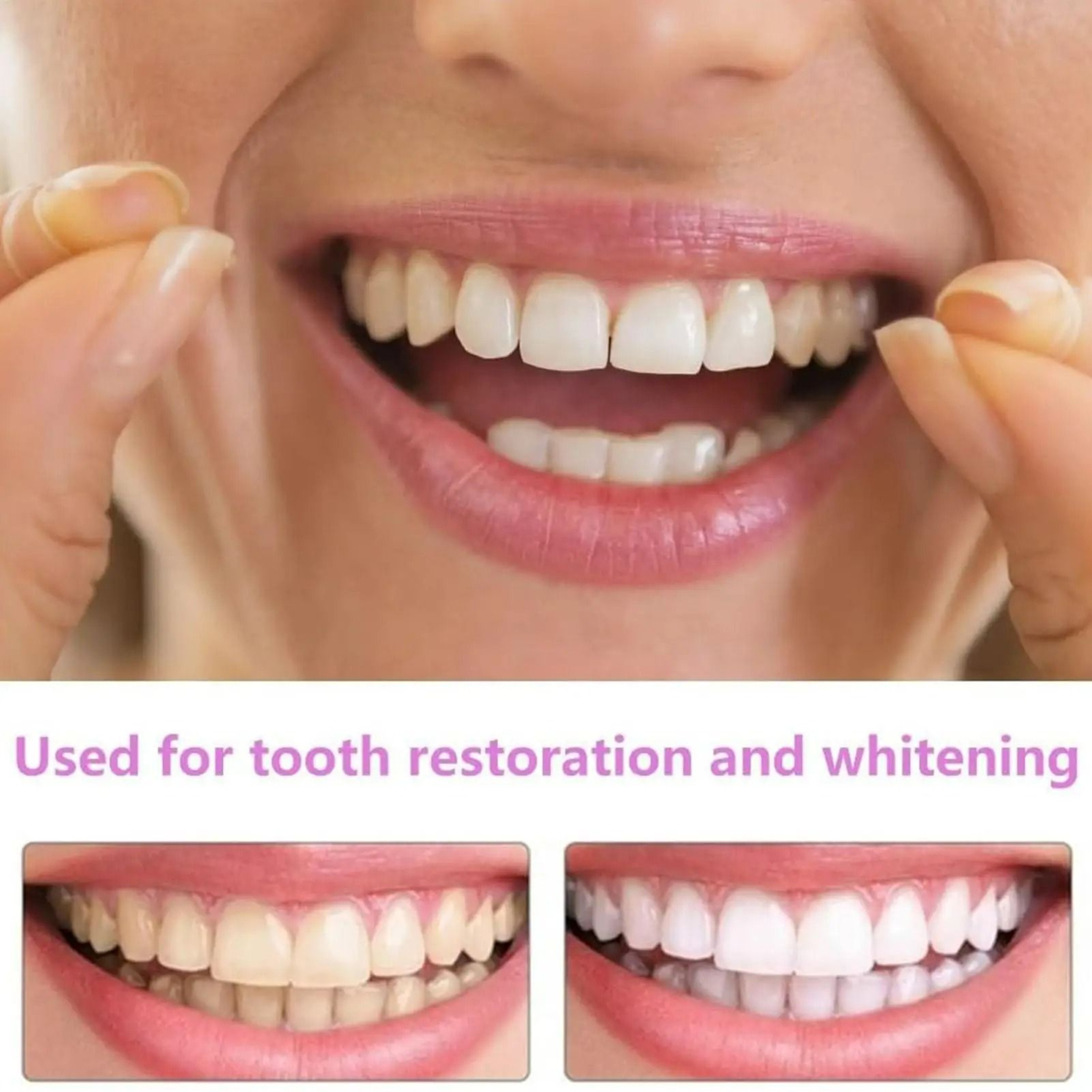 Instant Cosmetic Teeth Veneers Kit 5