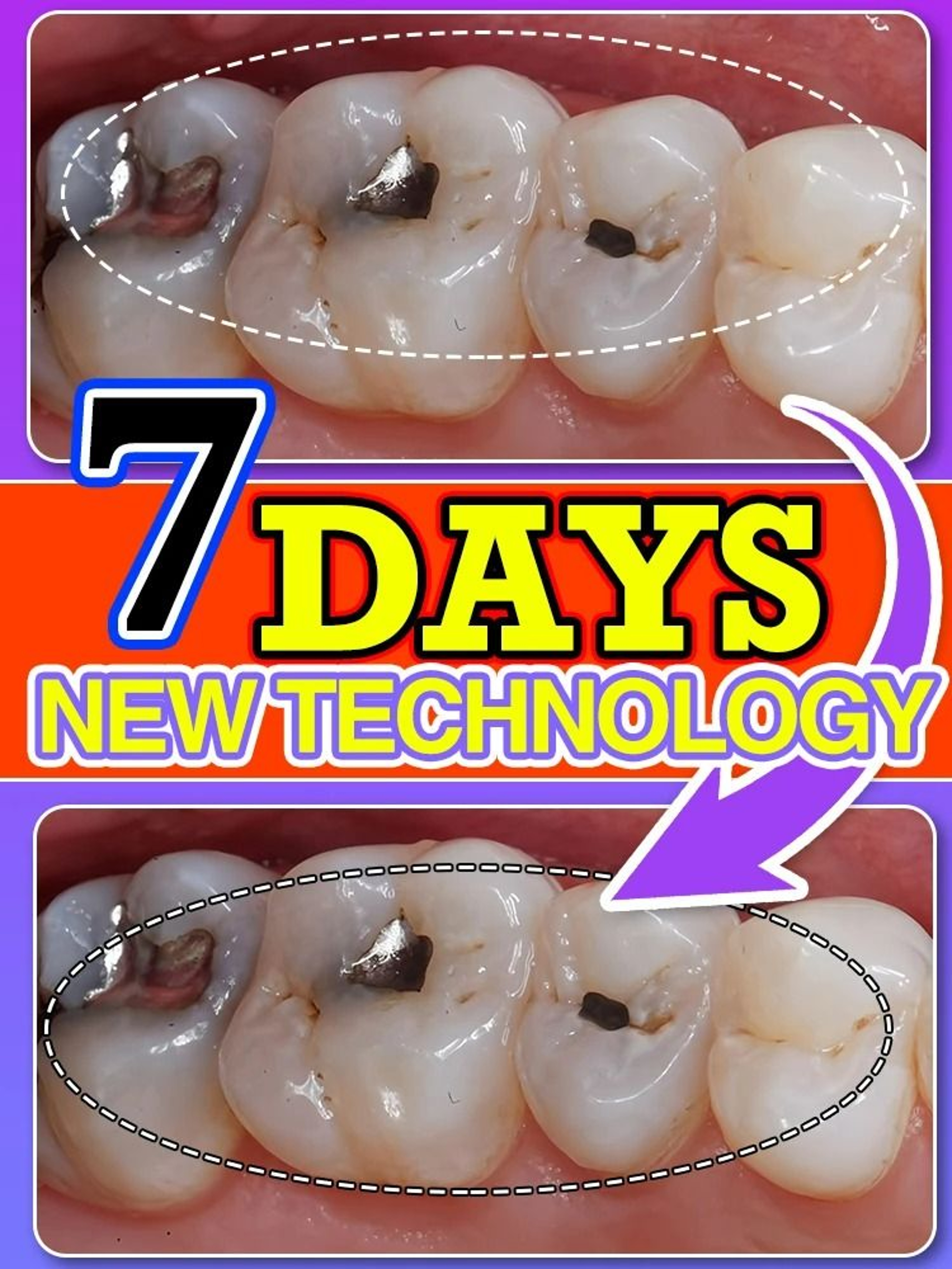 Advanced Enamel Repair  AntiCavity Toothpaste 1
