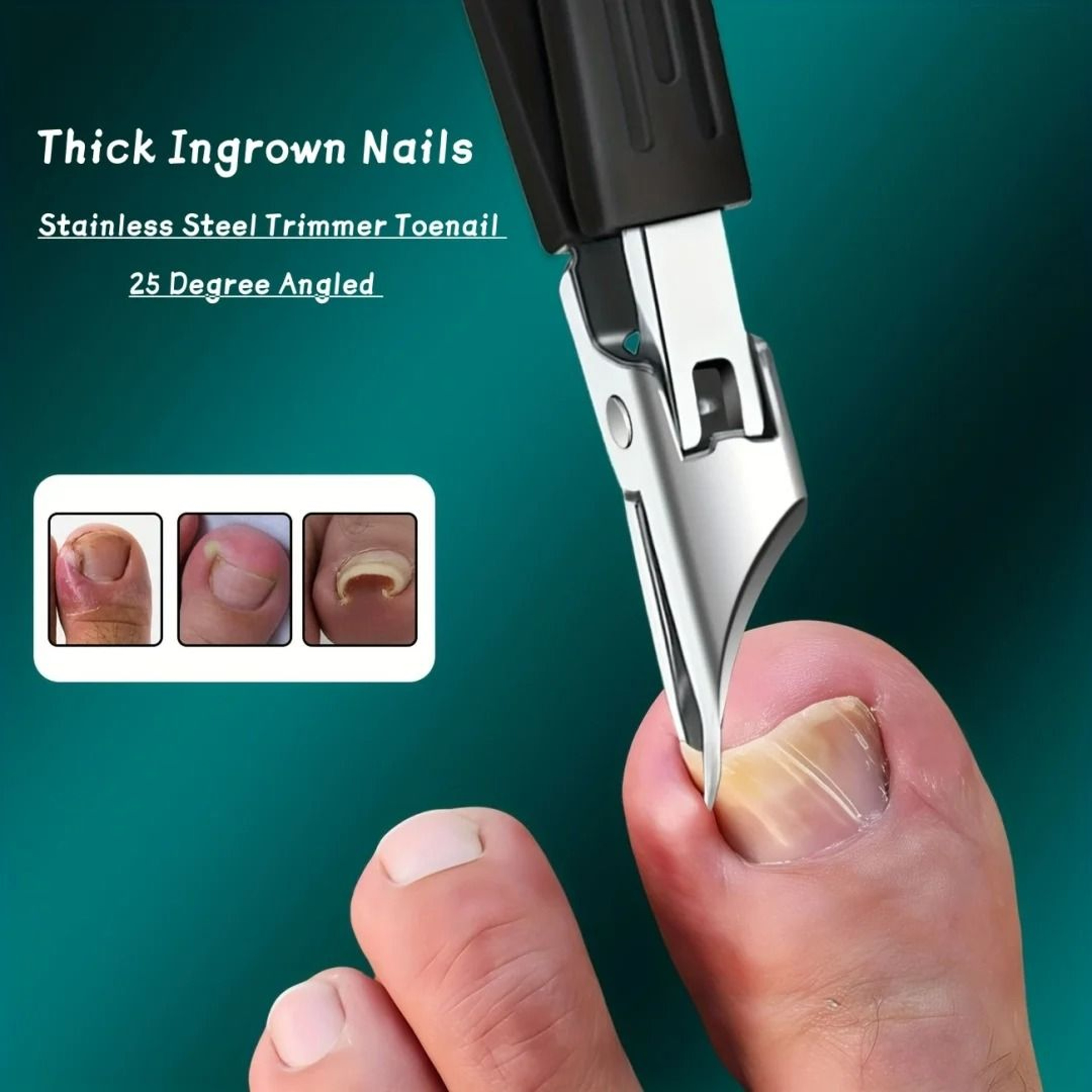 HeavyDuty Stainless Steel Precision Podiatry Clipper For Thick  Ingrown Toenails 1
