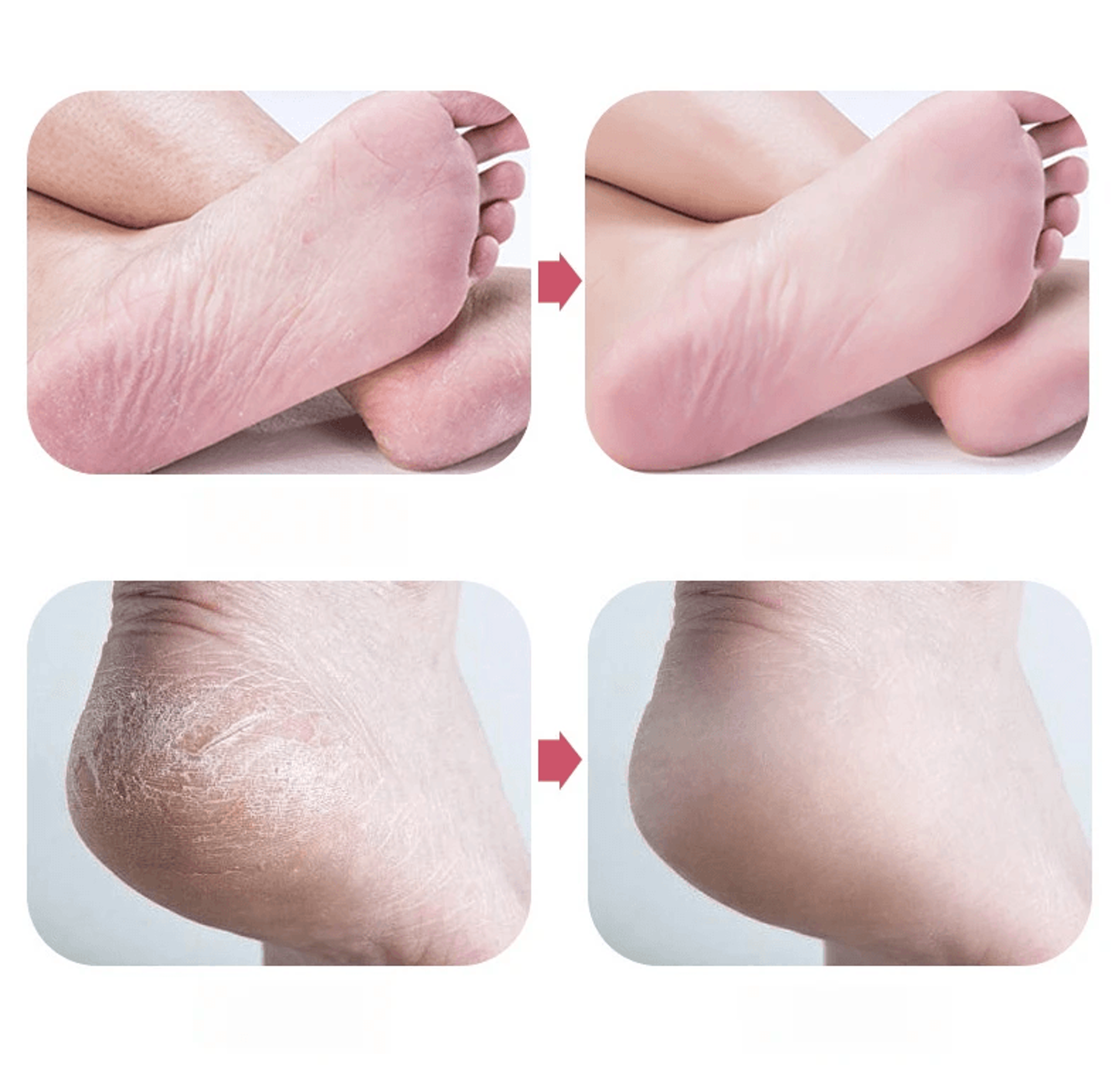 Nano Glass Foot Scrubber Callus Remover Smooth Heel File 1