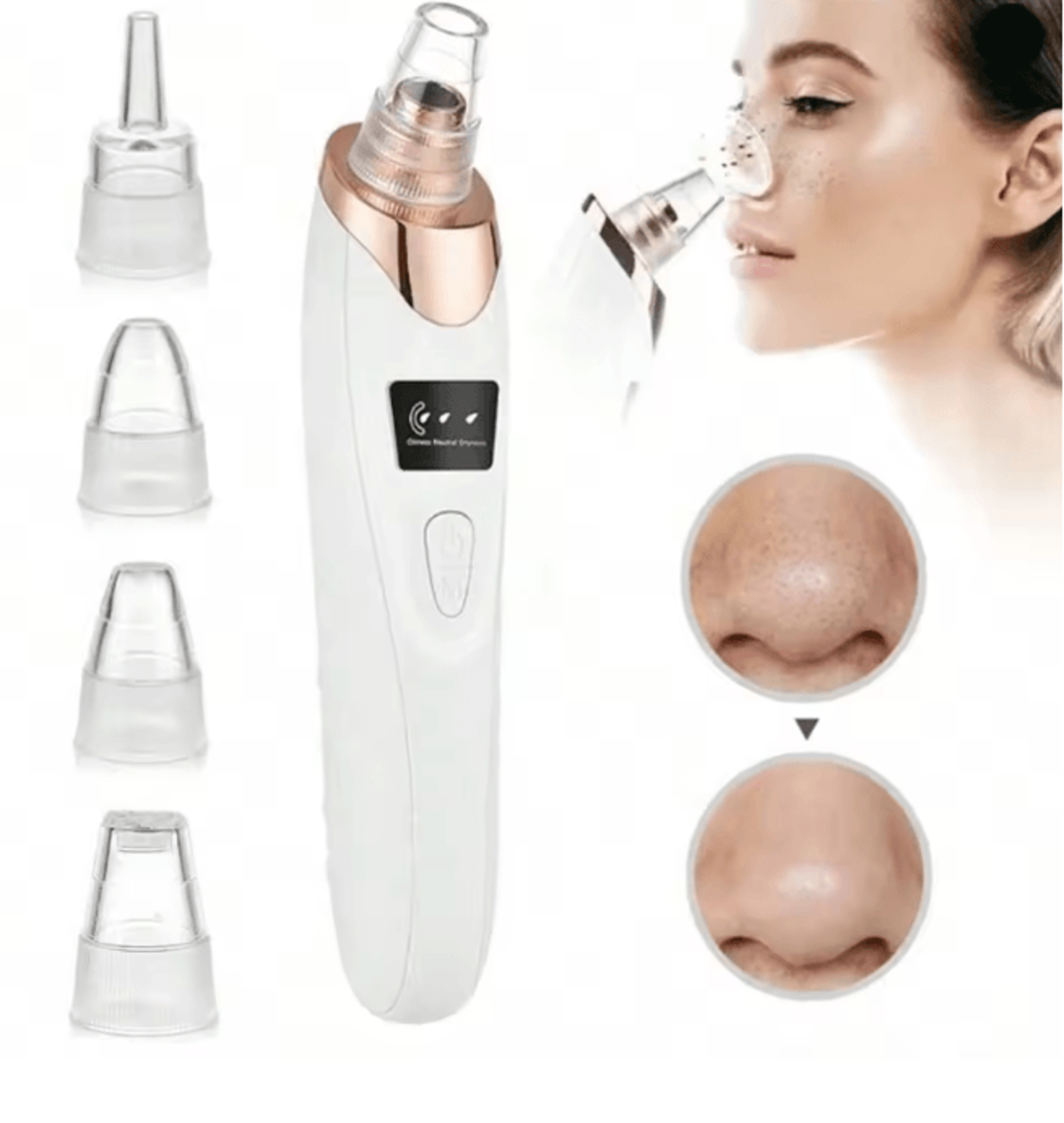 ClearGlow Facial Pore Cleaner Blackhead Remover Vacuum Kit 4