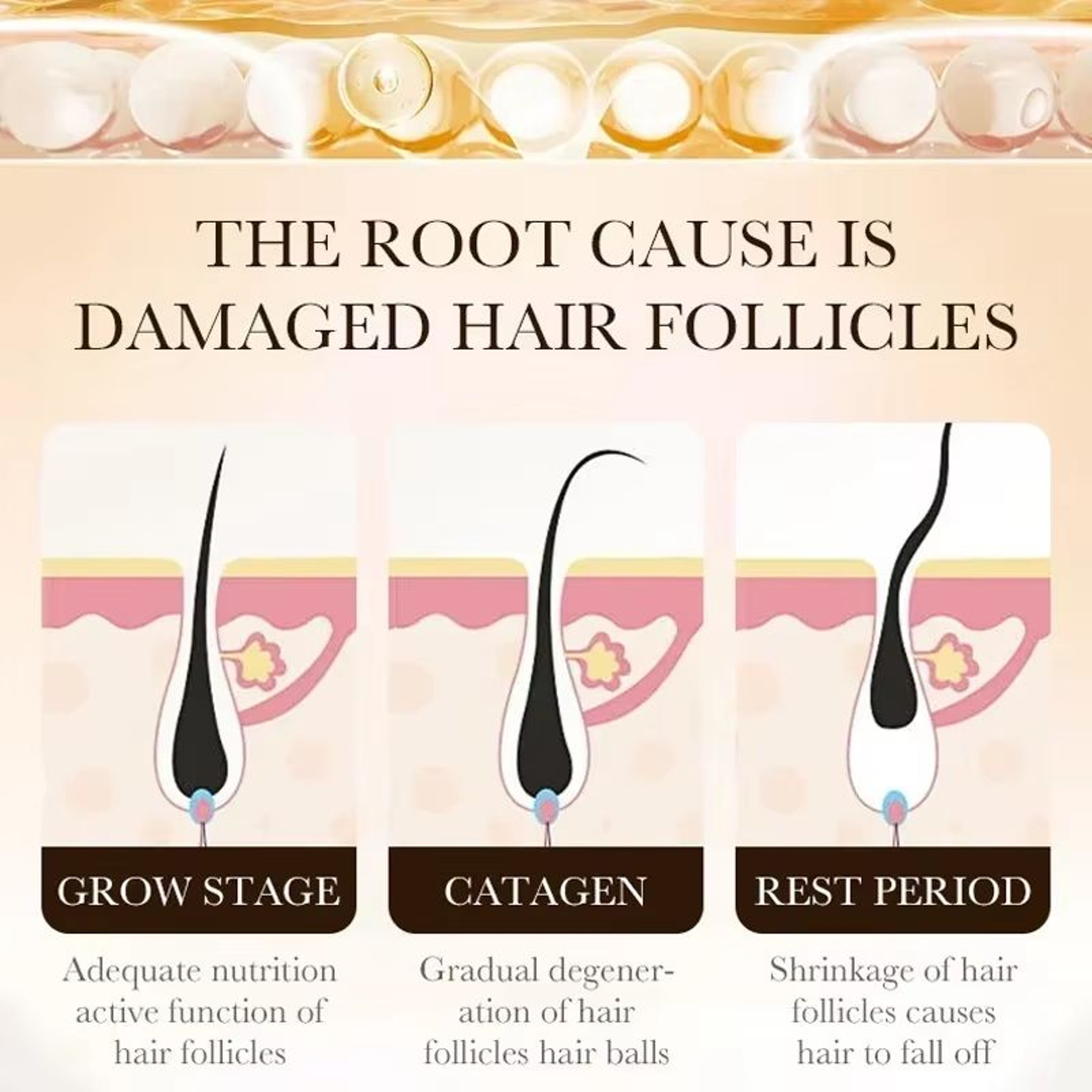 Vita Thick BiotinBoost Hair Growth Oil  Intensive Scalp  Hair Loss Repair Treatment 4