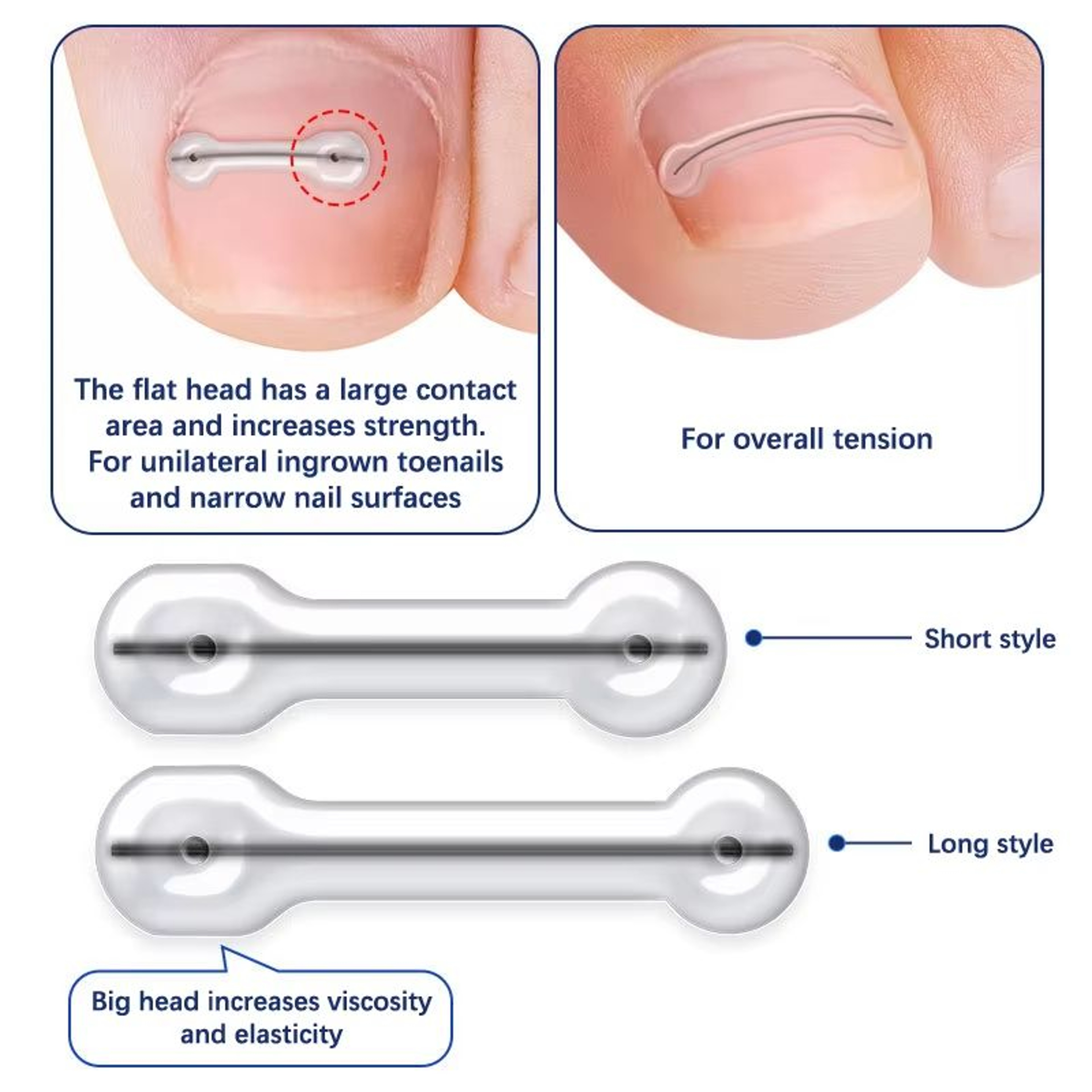 Ingrown Toenail Correction Patch Set Elastic Toe Nail Brace Pedicure Tool 1