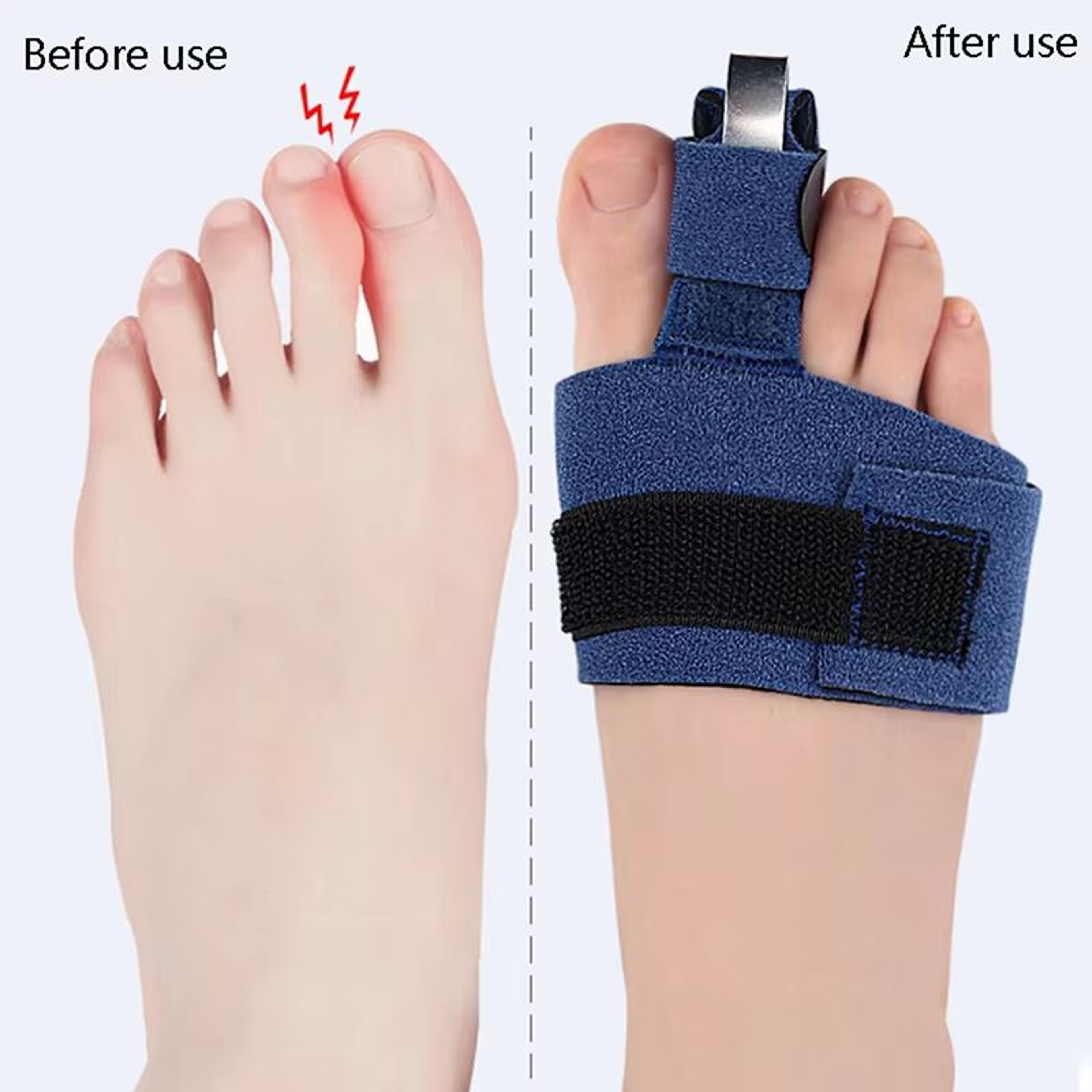 Toe Corrector Bunion Straightener Orthotic Pedicure Sock  Soft Big Toe Hallux Valgus Adjuster 3