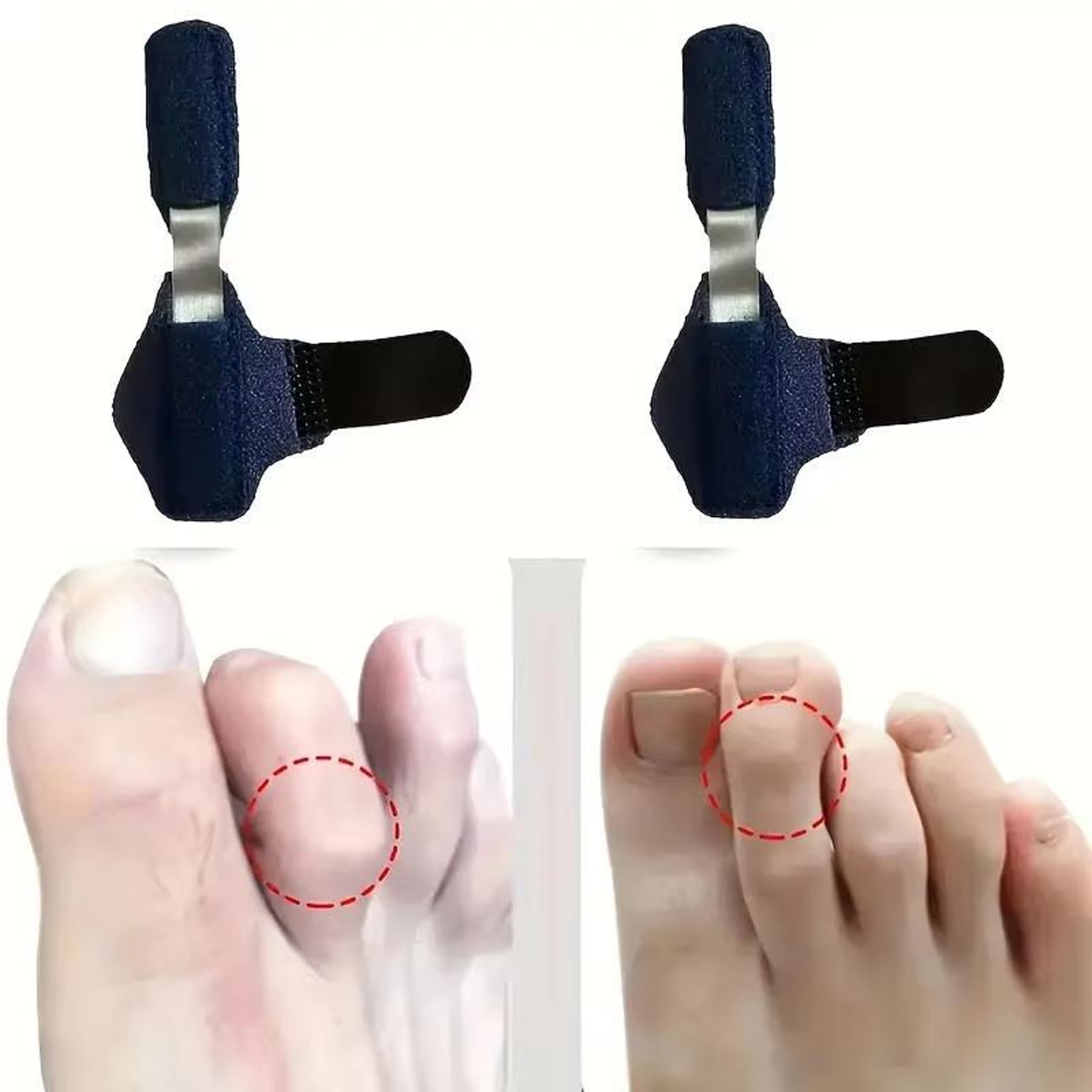 Toe Splint Straightener For Hammer Toe Corrector And Claw Toe Support Brace Kids And Adults 0