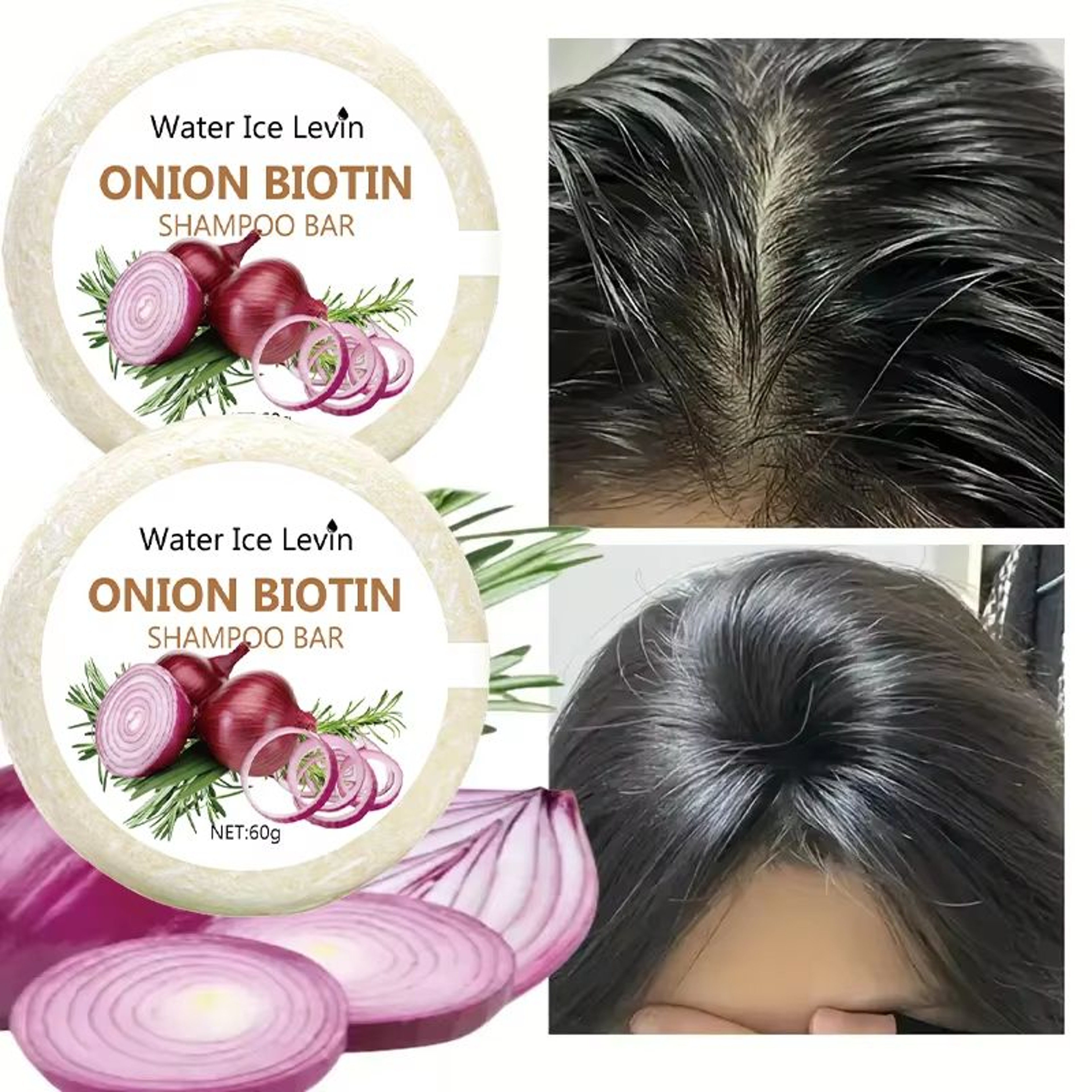 HerbaBoost Onion Biotin Shampoo Soap 212 Oz Moisturizing Smoothing Rosemary Extract Hair Bar 0