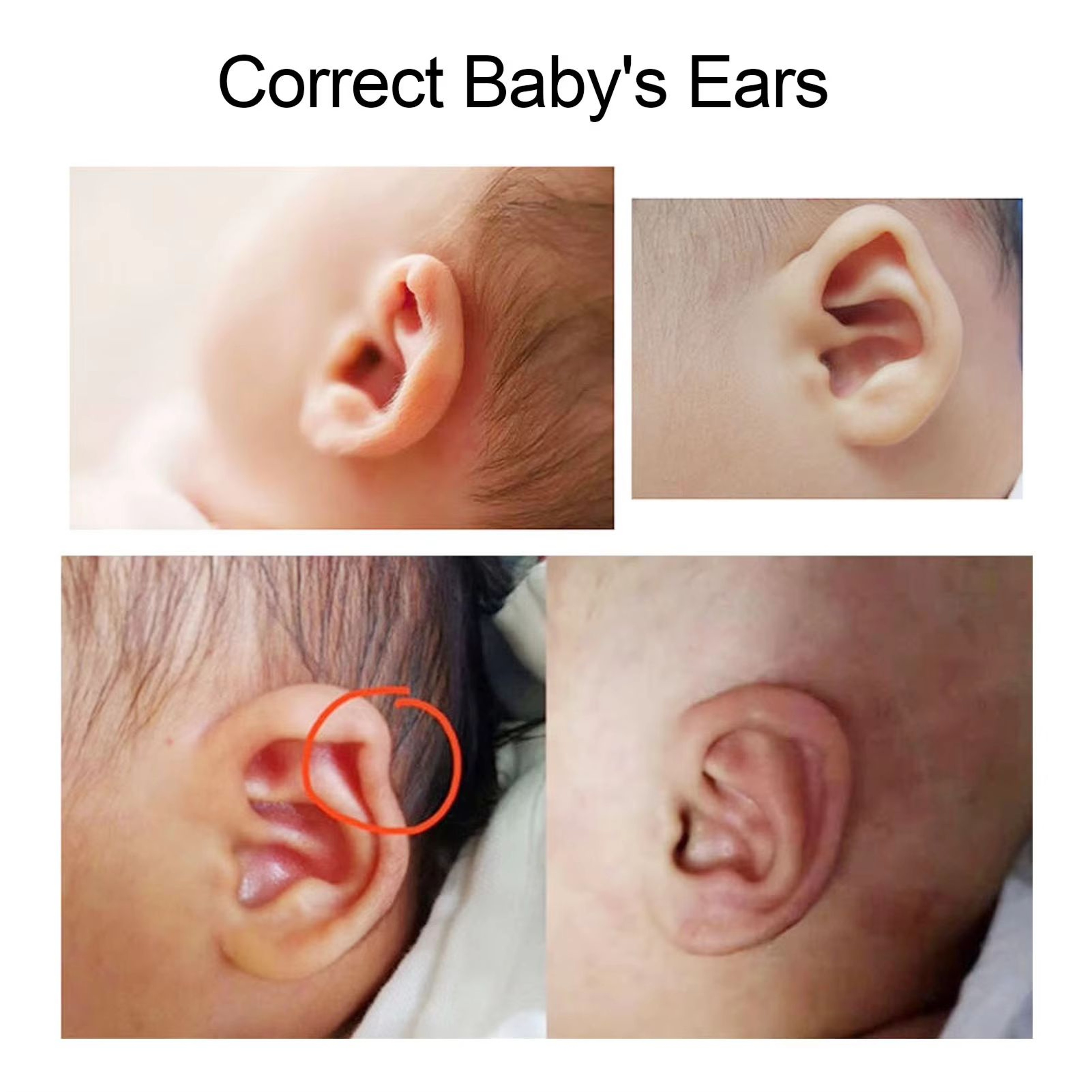 BabyEar Silicone Infant Ear Shape Corrector Patch Strip 4x1969 In  Gentle Protruding Ear Alignment  1