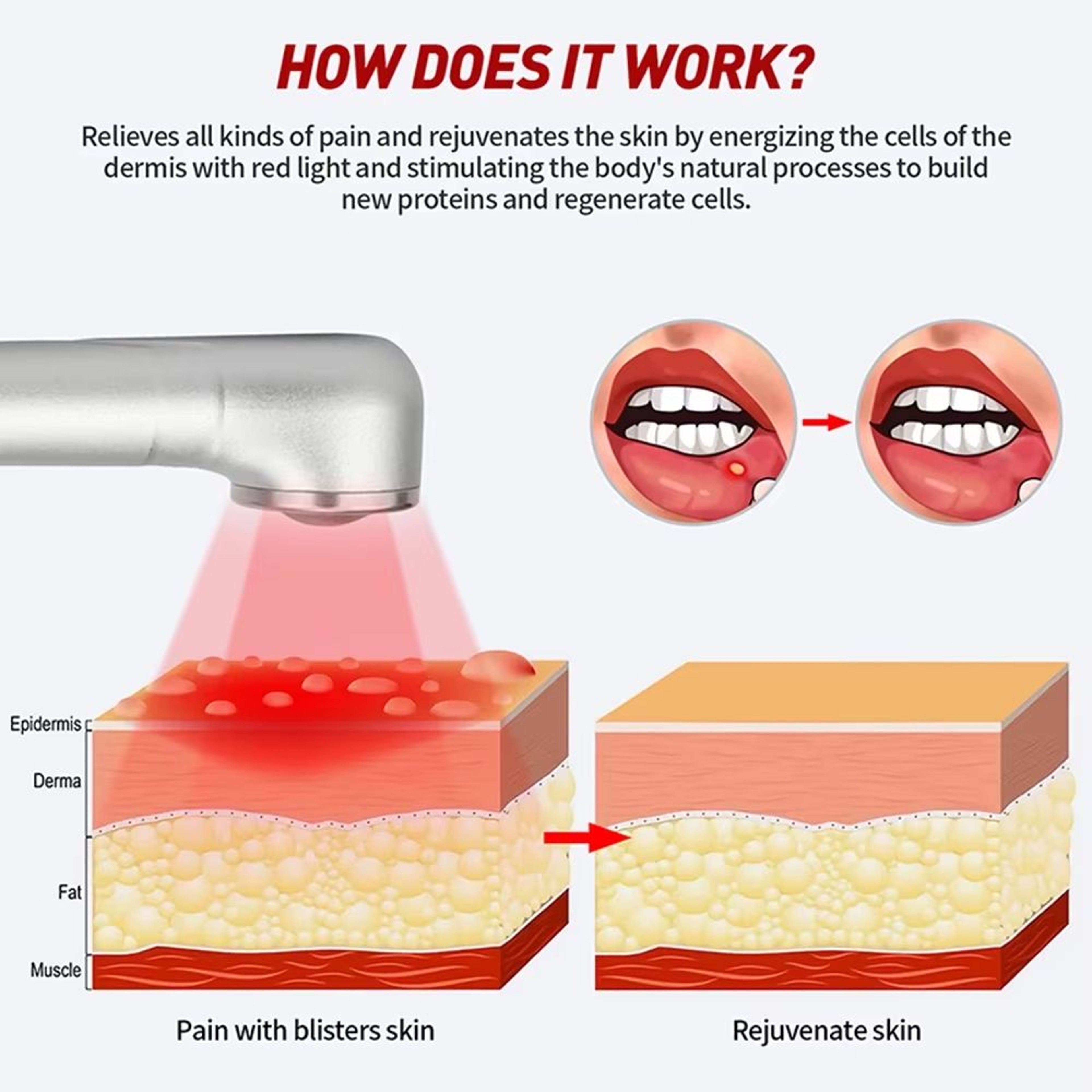 Red Light Therapy Cold Sore Treatment Device With 660 Nm And 850 Nm Near Infrared LED Light Wand 3