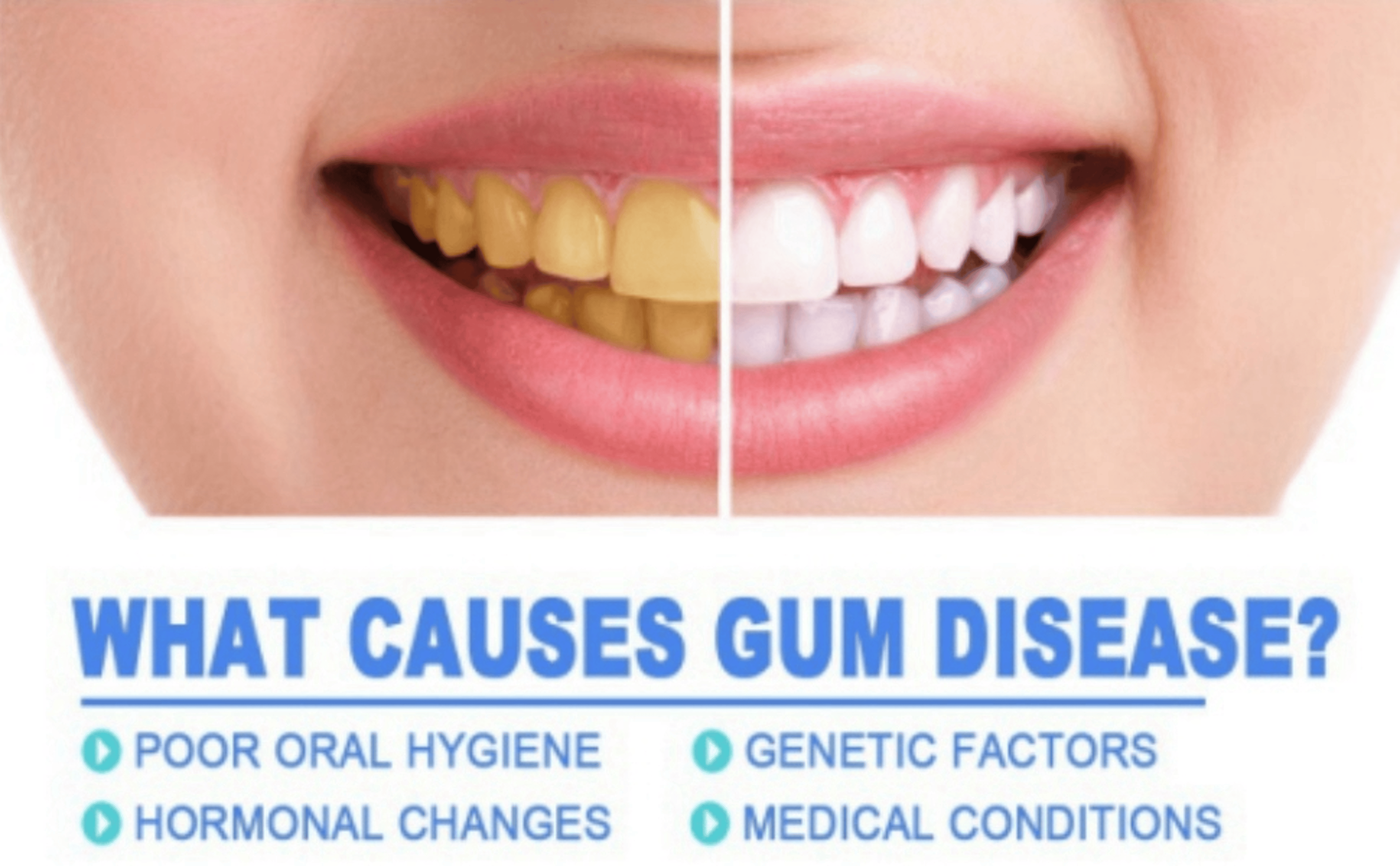 Rapid Repair Gums Serum, Instant Relief for Sensitive Teeth, Cavities & Gum Damage – view 10