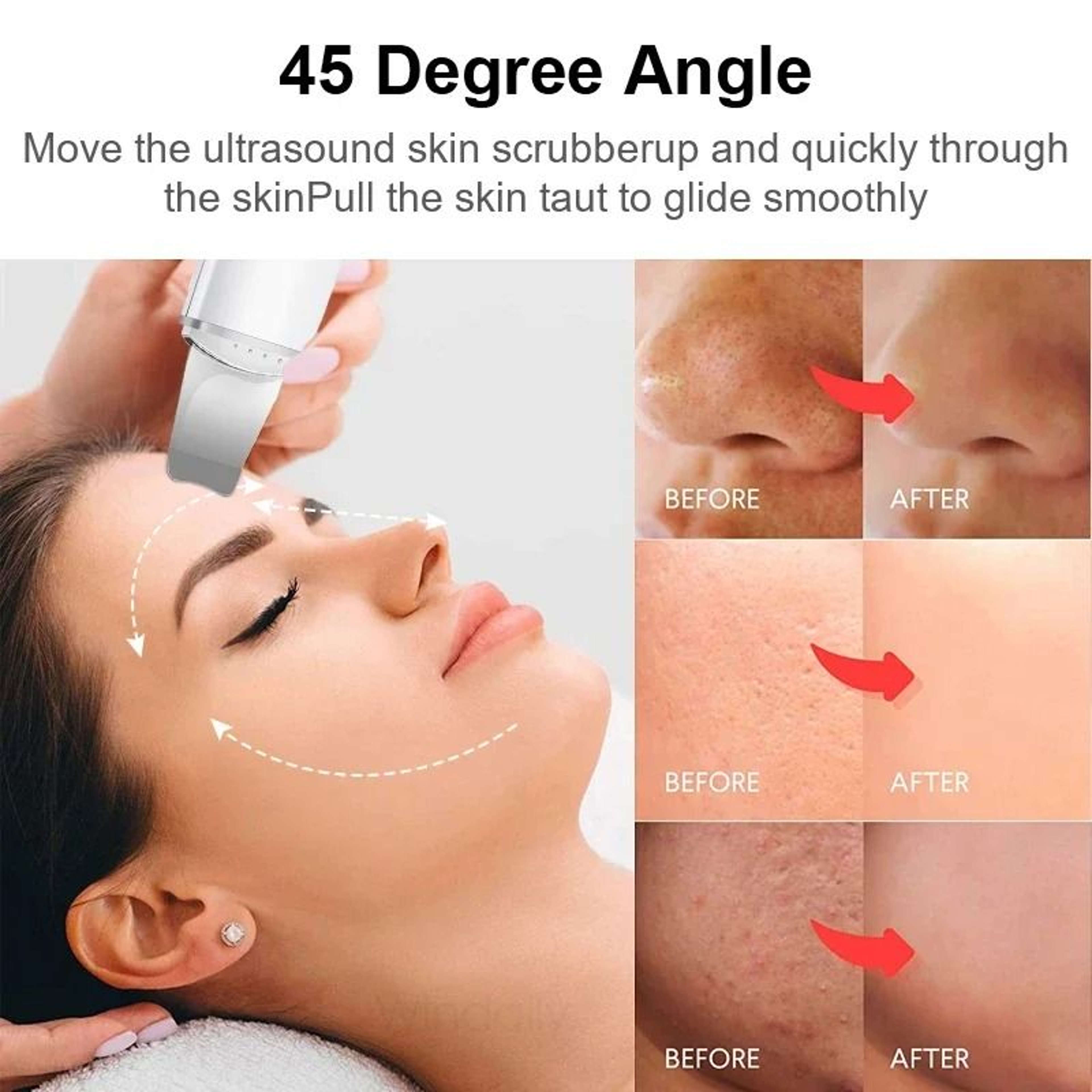 Ultrasonic Skin Scrubber Face Spatula For Deep Cleansing  Blackhead Removal 6