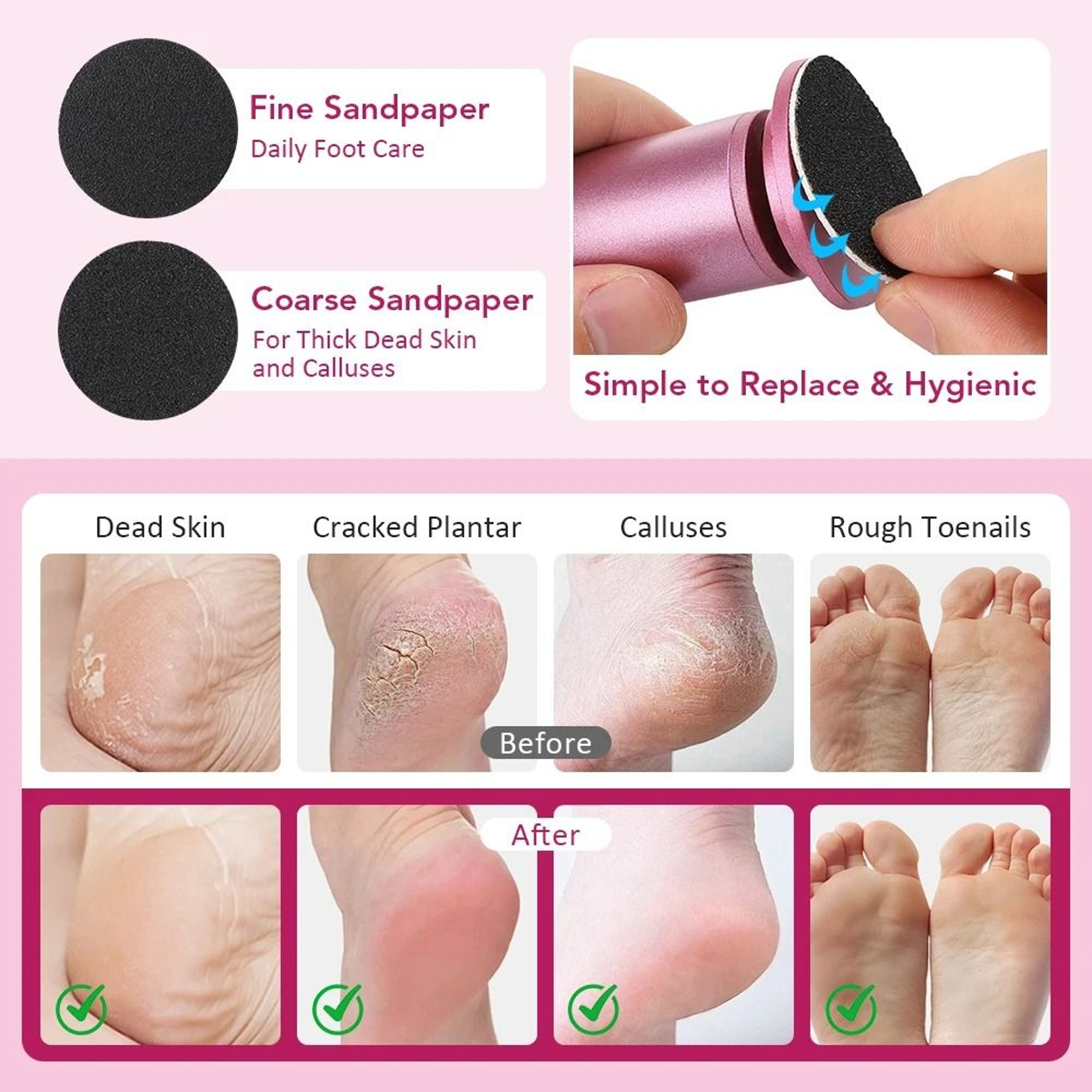 Professional Electric Foot Callus Remover Foot Exfoliator For Smooth Cracked Heels 2