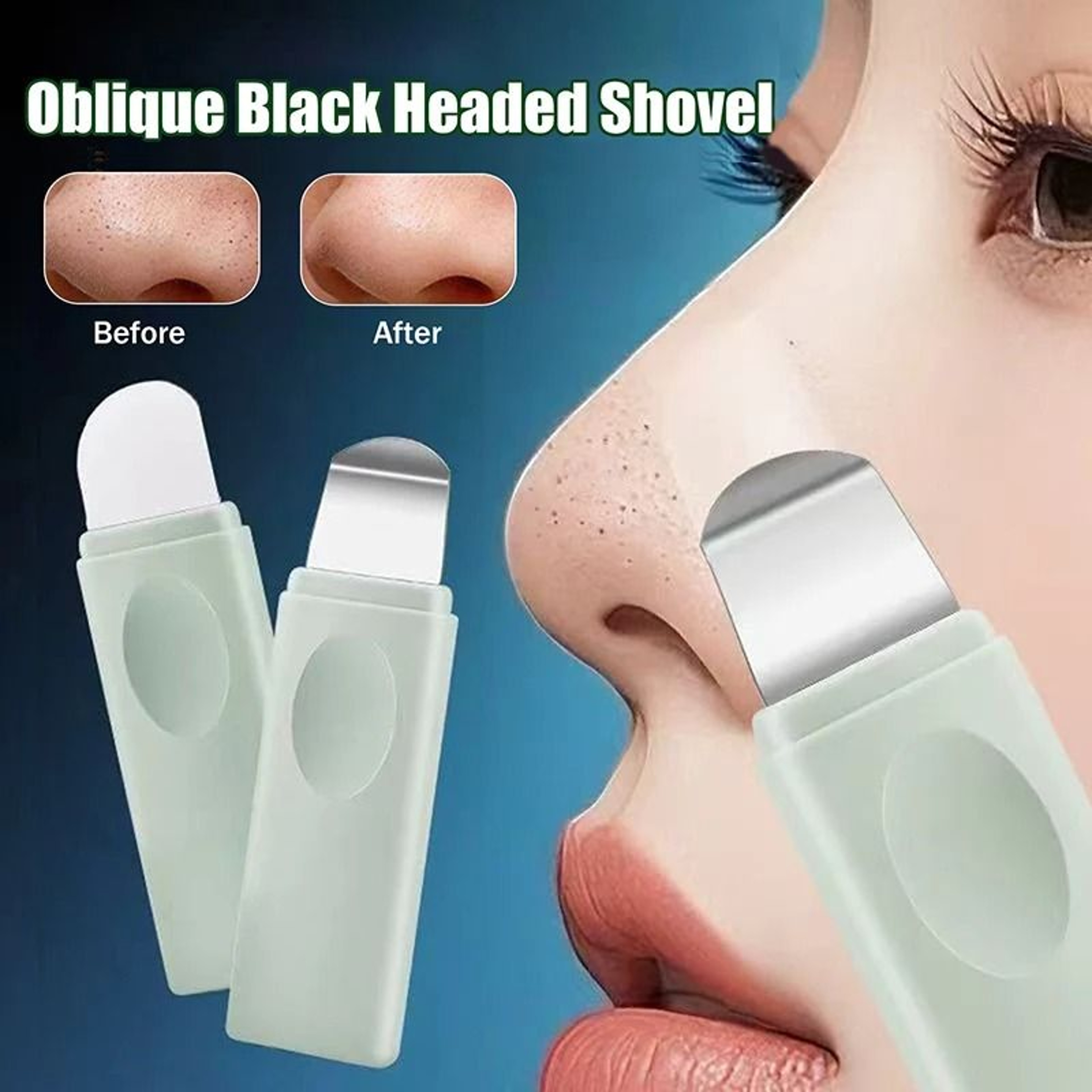 Manual Blackhead  Whitehead Remover Tool For Deep Pore Cleansing 0