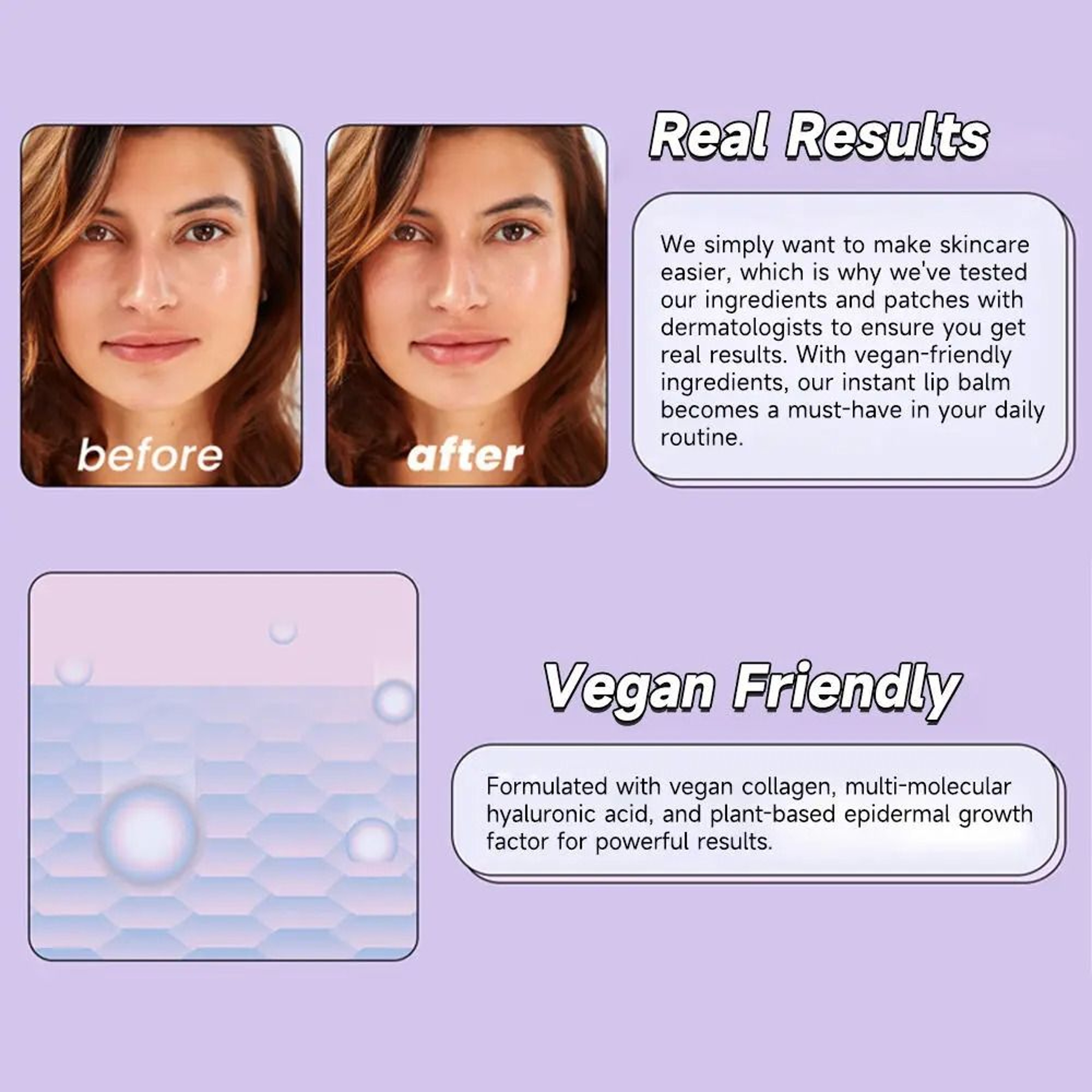 Smile Lift Firm Lips Patch Hyaluronic Acid Microneedle Lip Patches For Anti Wrinkle Mouth 3
