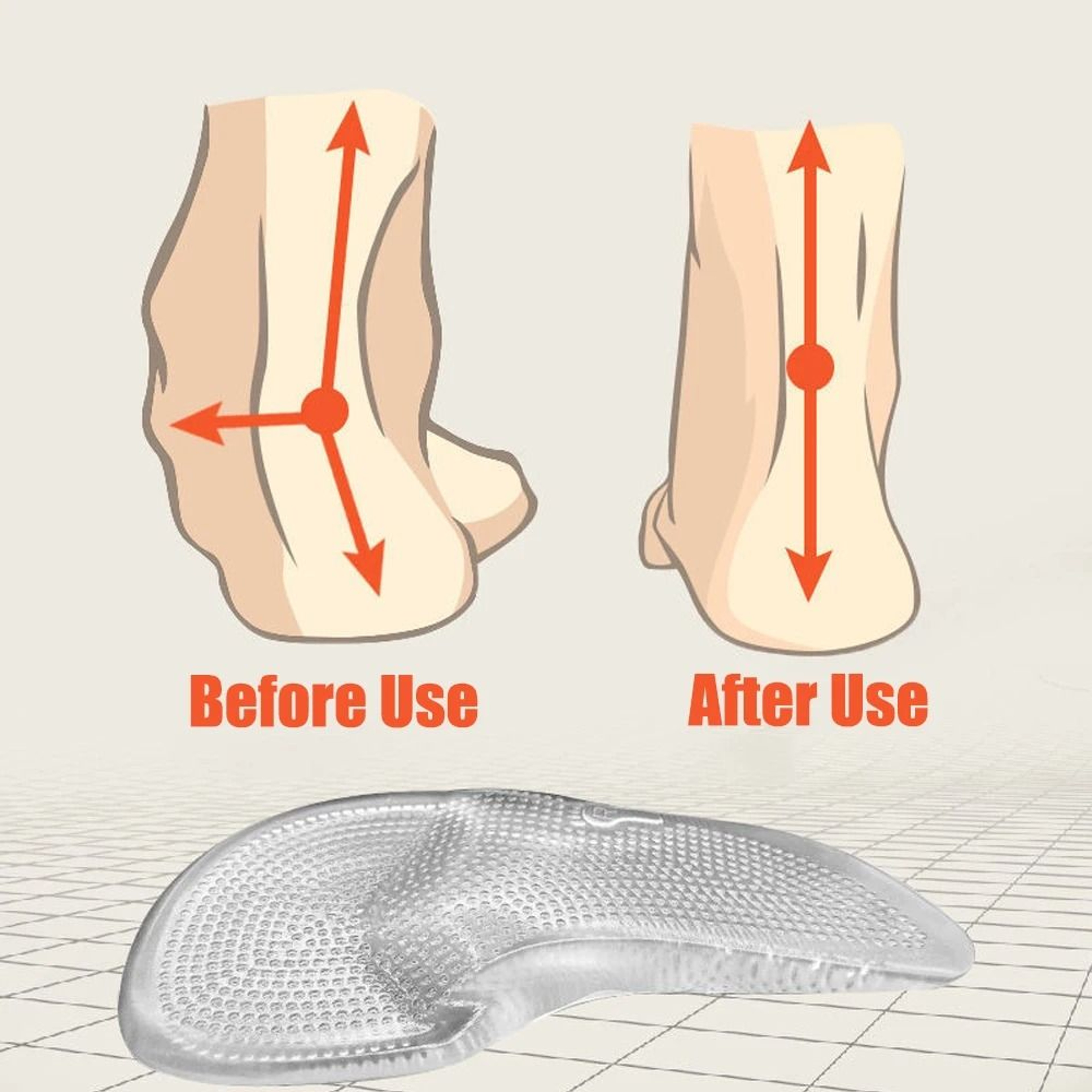 Silicone Gel Orthopedic Insoles For Women Flat Feet And Arch Support 3
