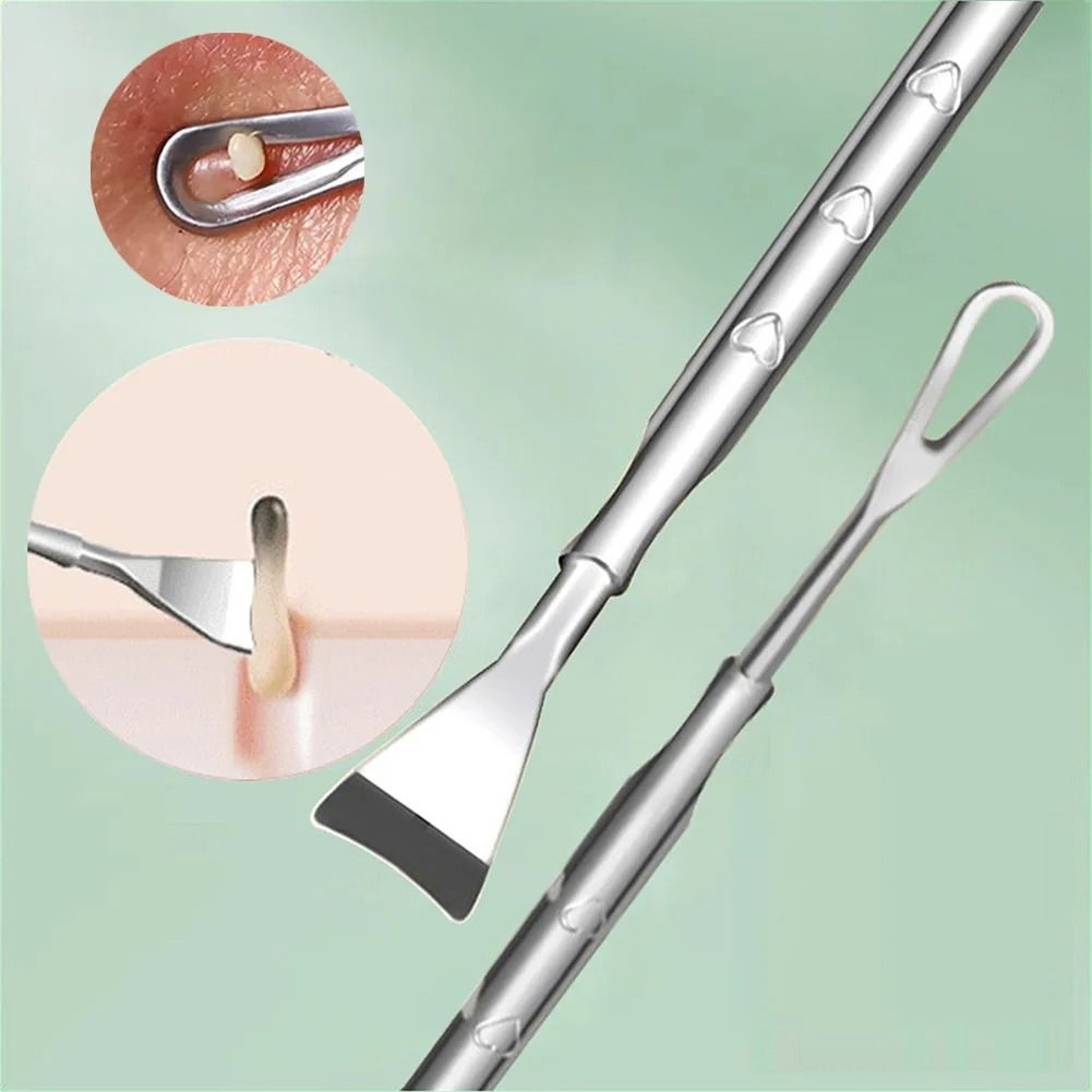 Double Ended Stainless Steel Blackhead And Acne Removal Needle For Facial Cleaning 2