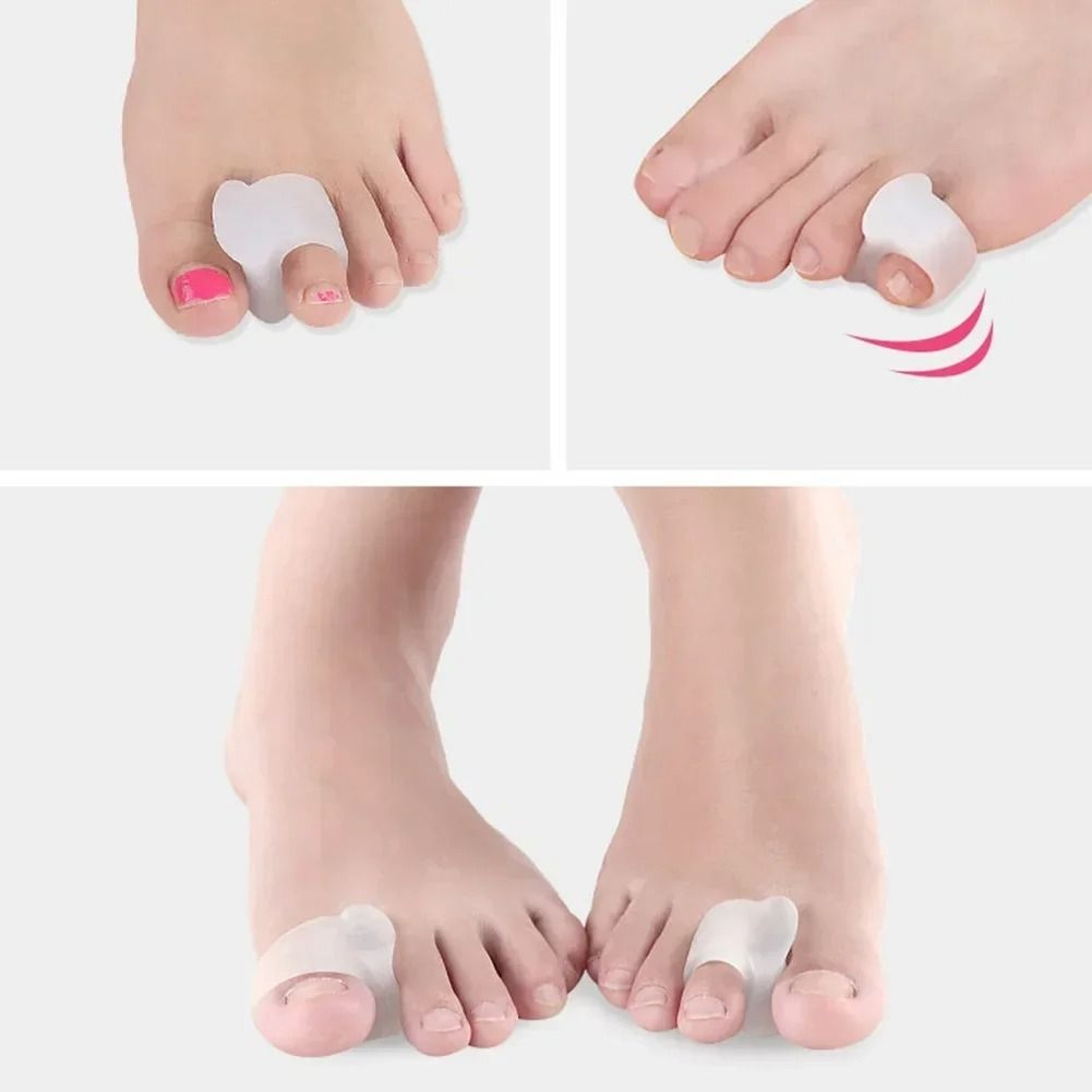 Silicone Toe Separator And Bunion Guard Set For Foot Alignment And Pain Relief 4