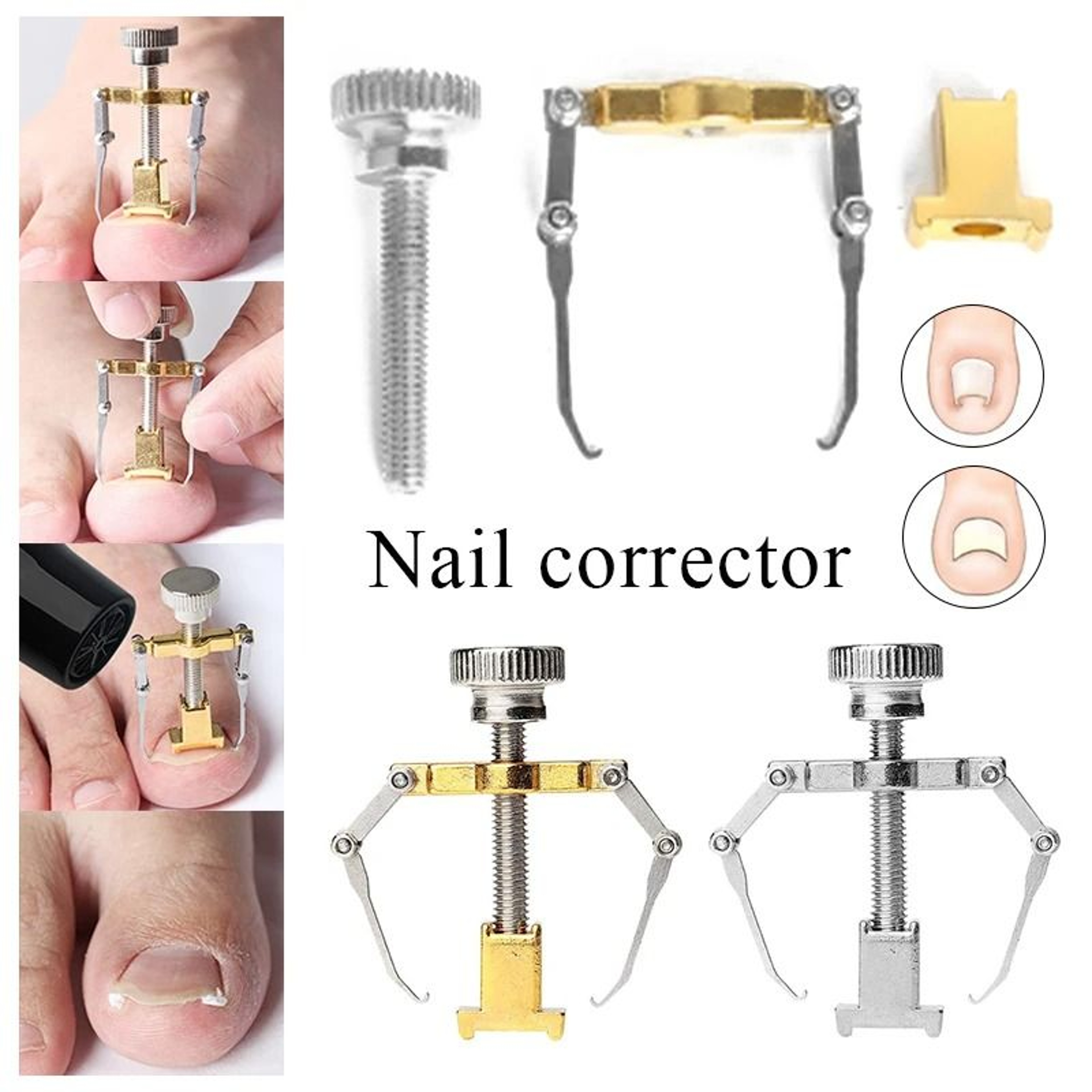 Stainless Steel Ingrown Toenail Corrector Set 3