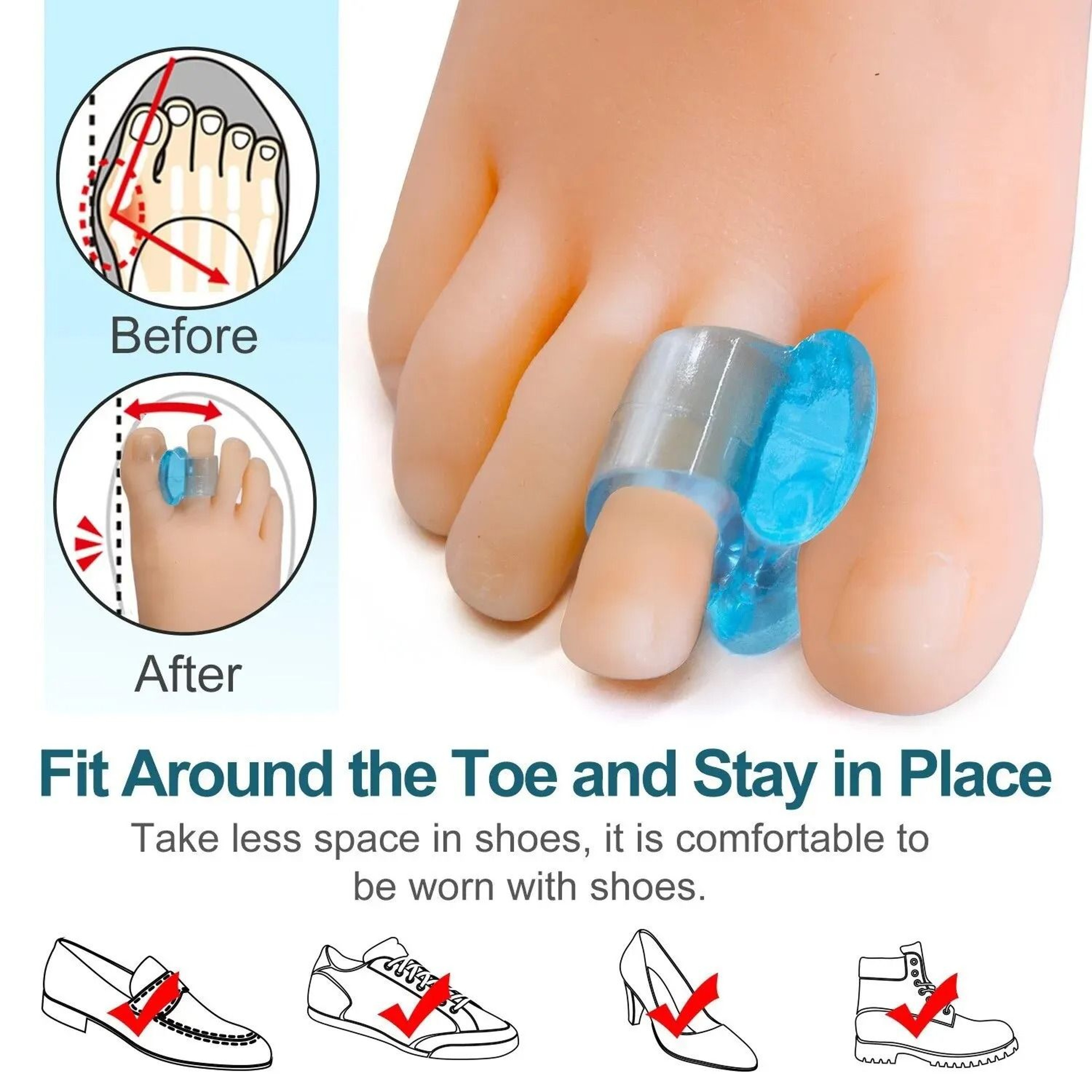 Bunion Valgus Corrector And Toe Divider Set 2