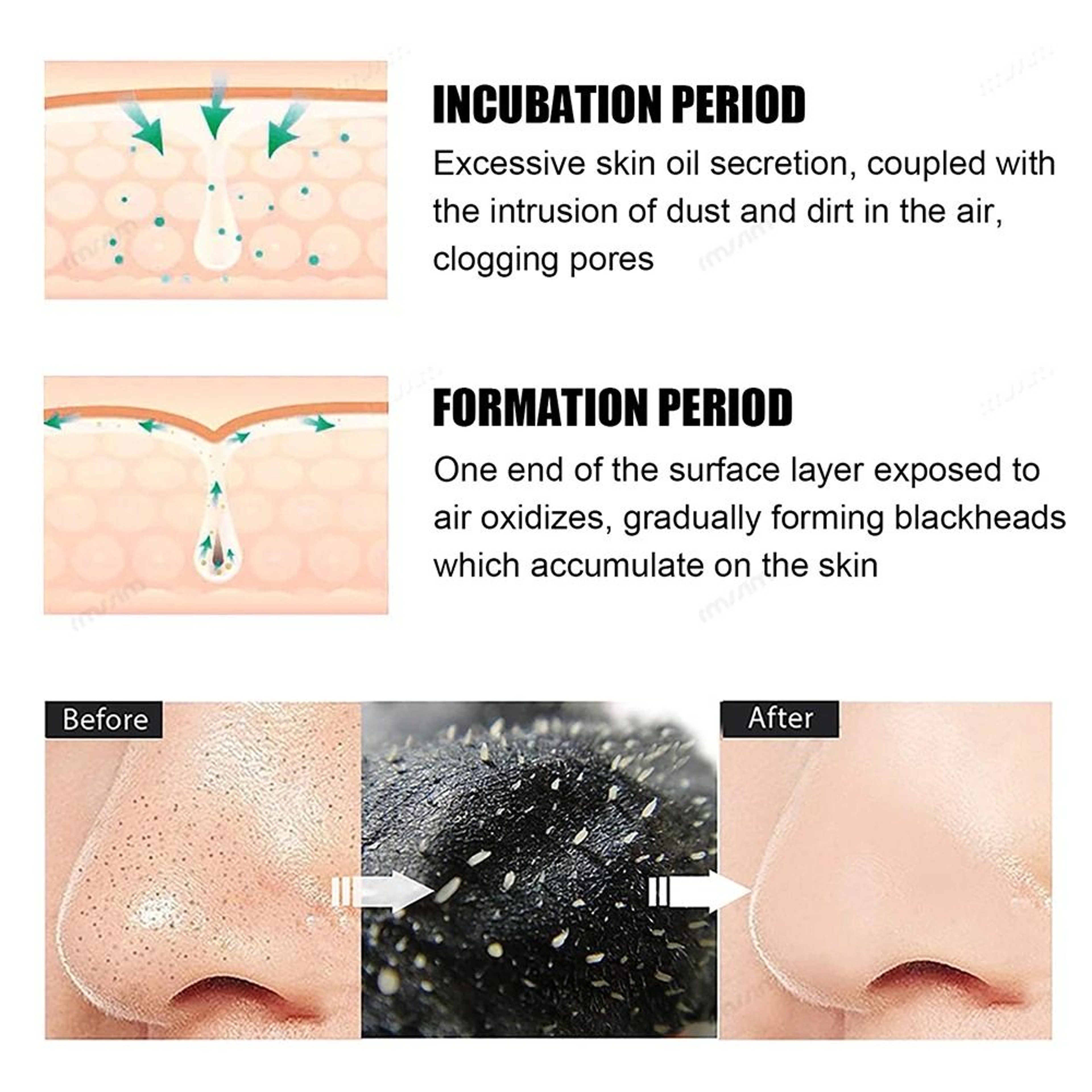 Black Pig Nose Stick Bamboo Charcoal Blackhead Remover Pore Cleaning Acne Treatment Strip 1