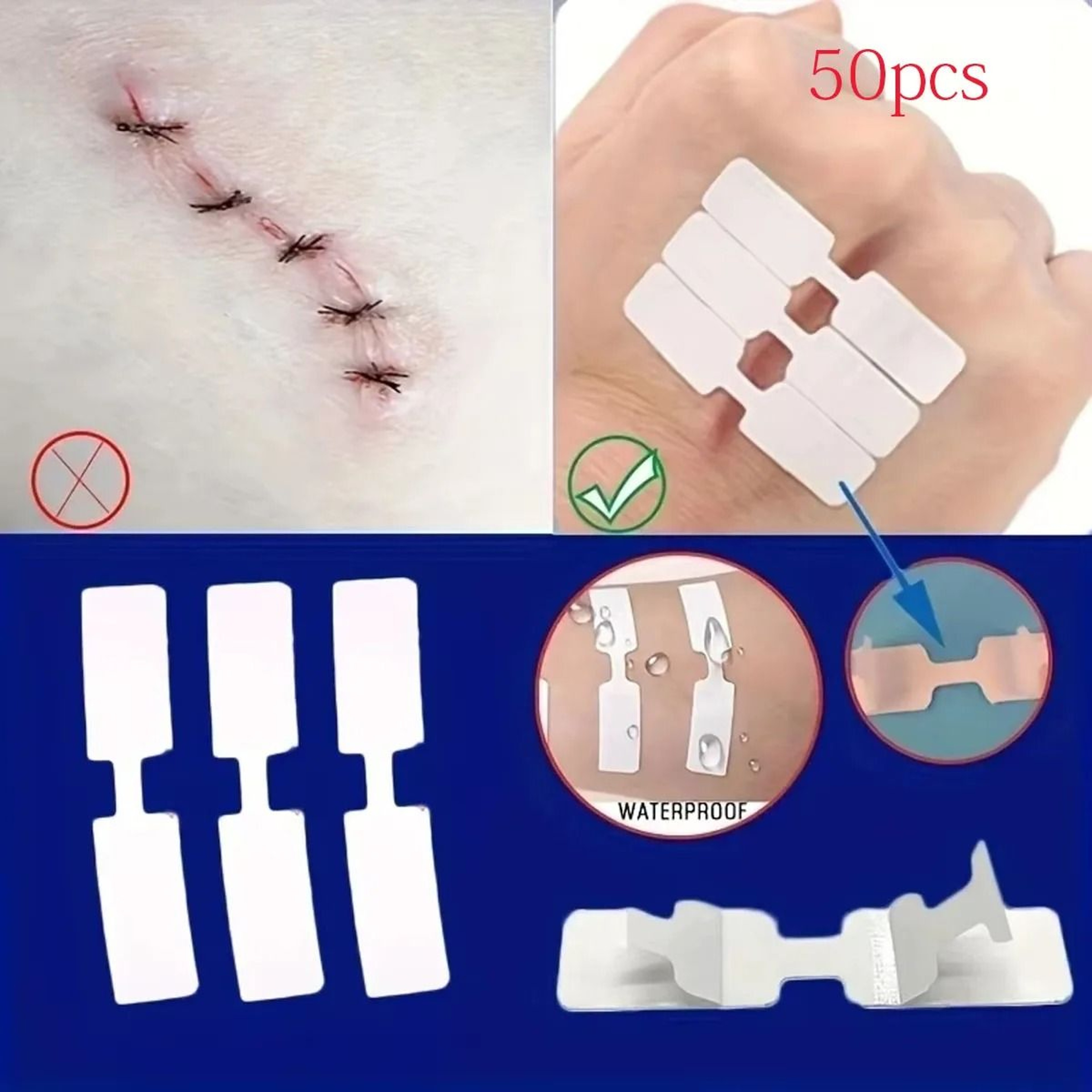 5Piece Outdoor Quick Suture Patch And Emergency Wound Adhesive Tape Kit 5