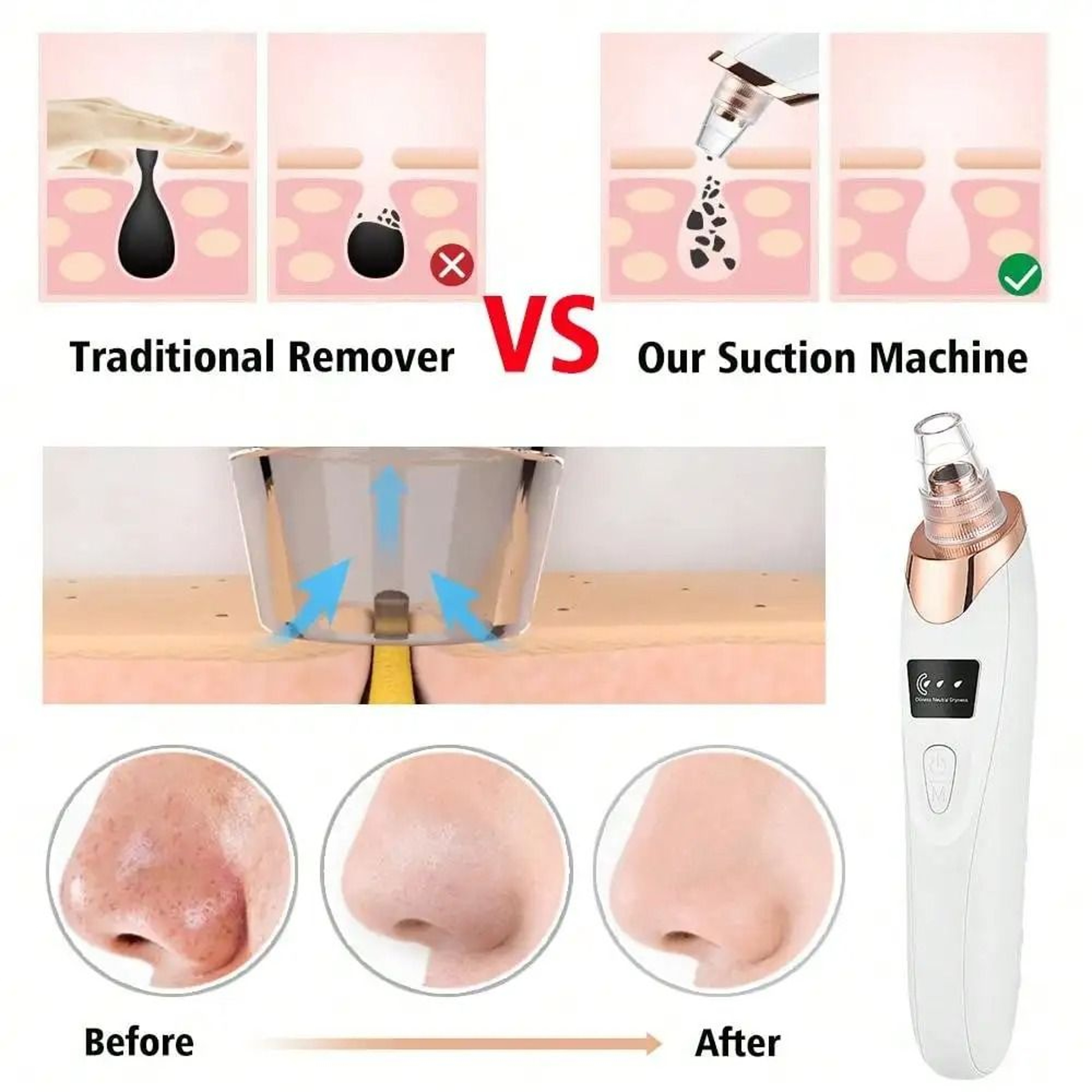 Pore Vacuum Deep Cleansing System  MultiProbe Blackhead Remover  Boutique Facial Maintenance Sanctu 4