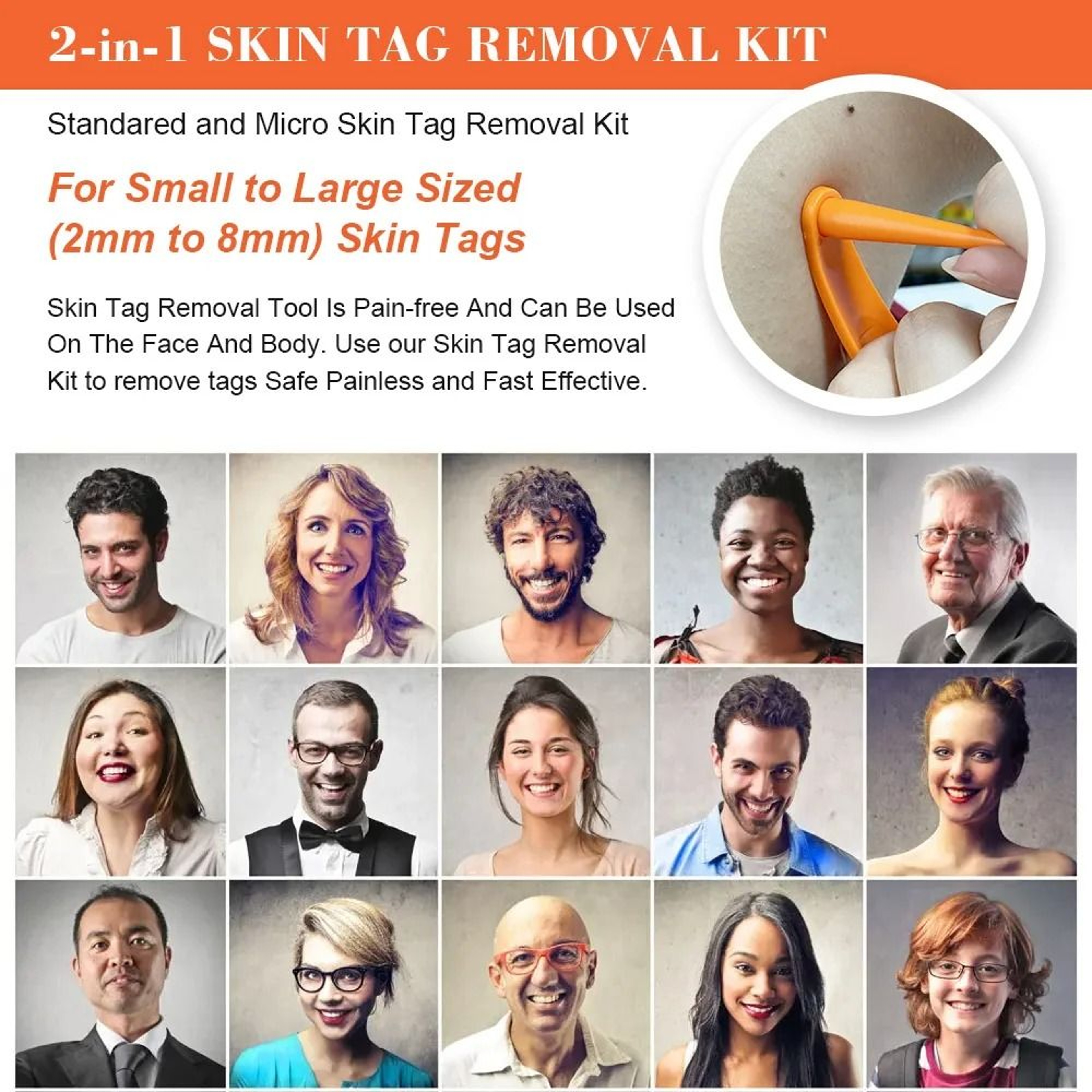 2in1 Precision Skin Tag Removal System 3