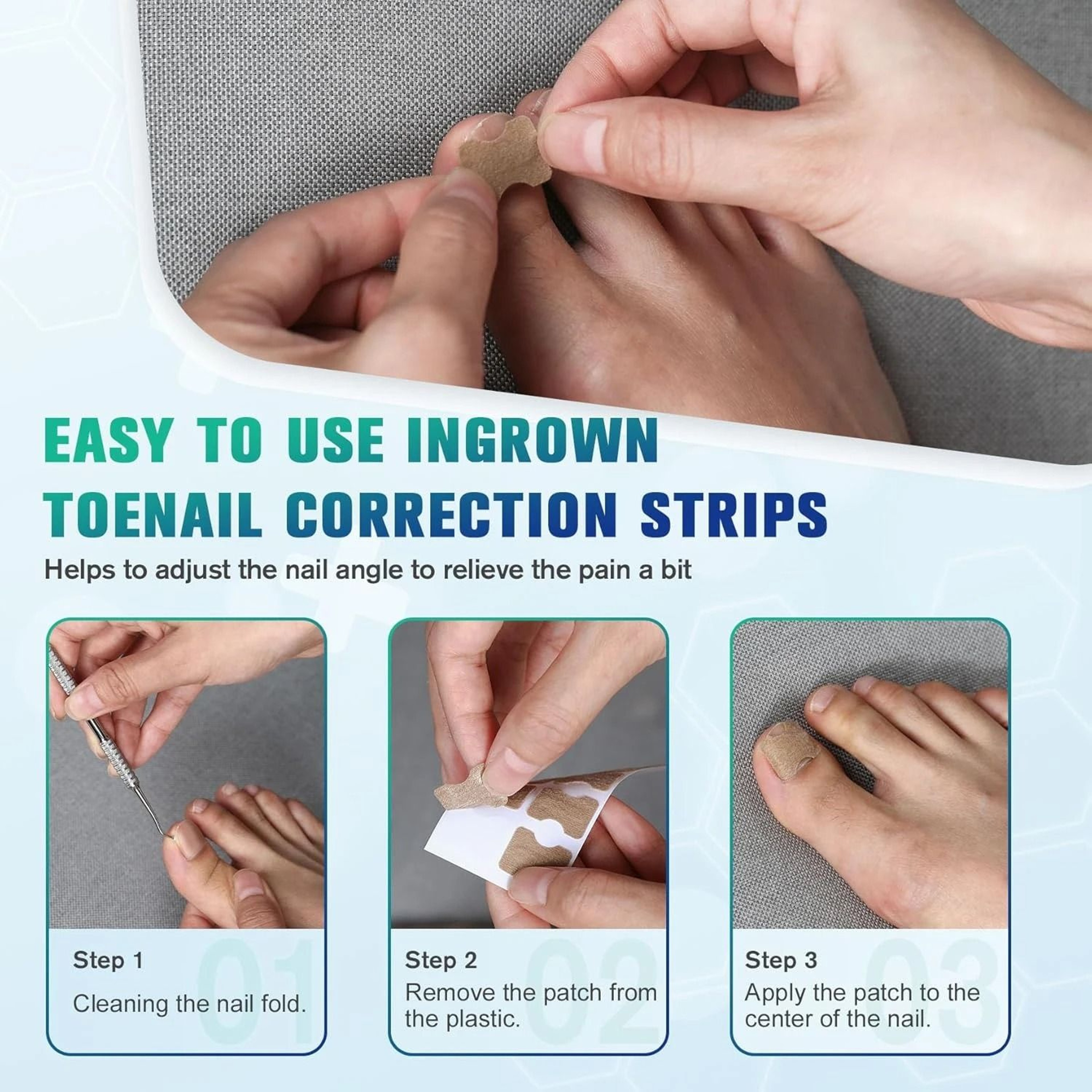 50 And 100 Pcs Nail Correction Stickers For Ingrown Toenail Care 2