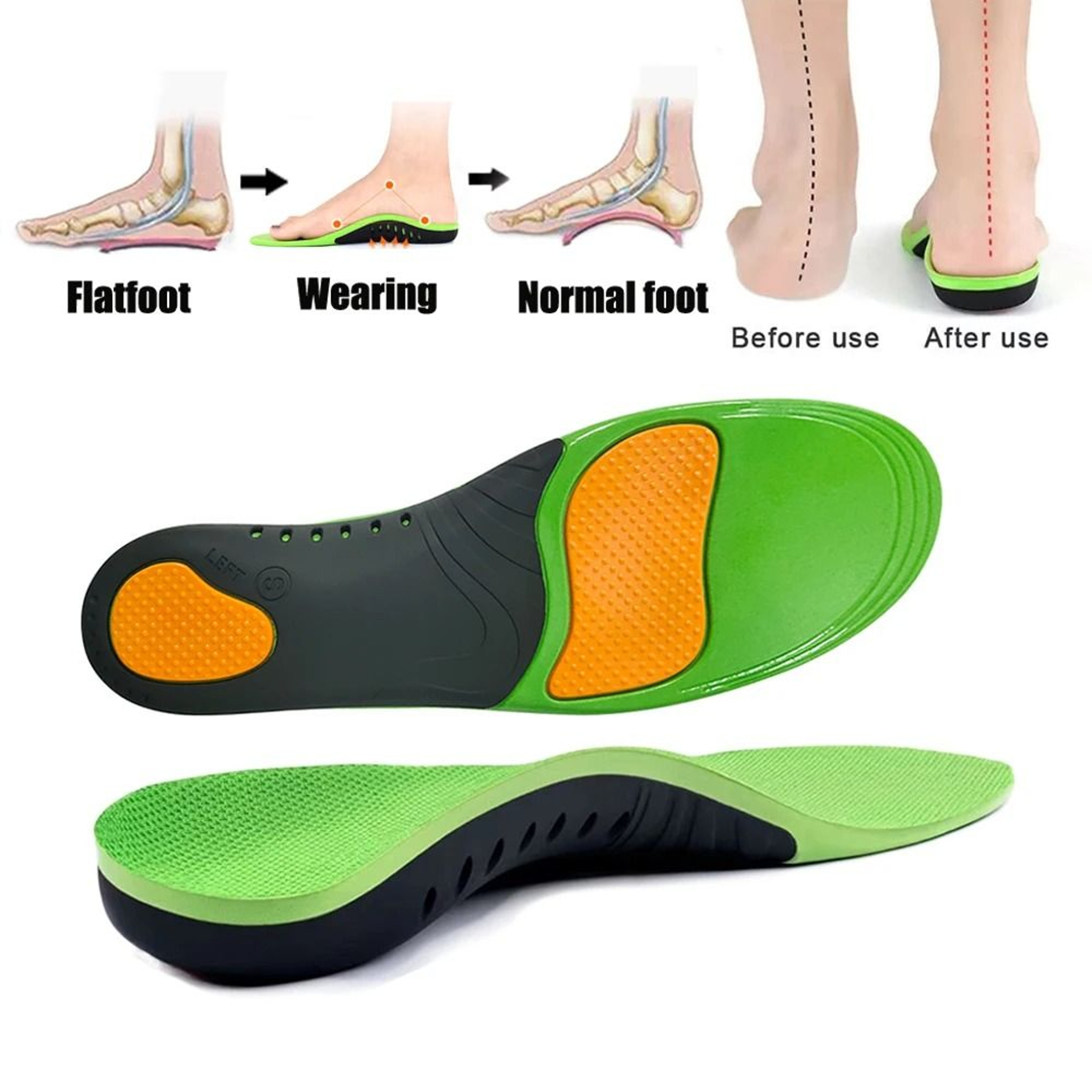 Premium Silicone Gel Shoe Insoles With Arch Support 0