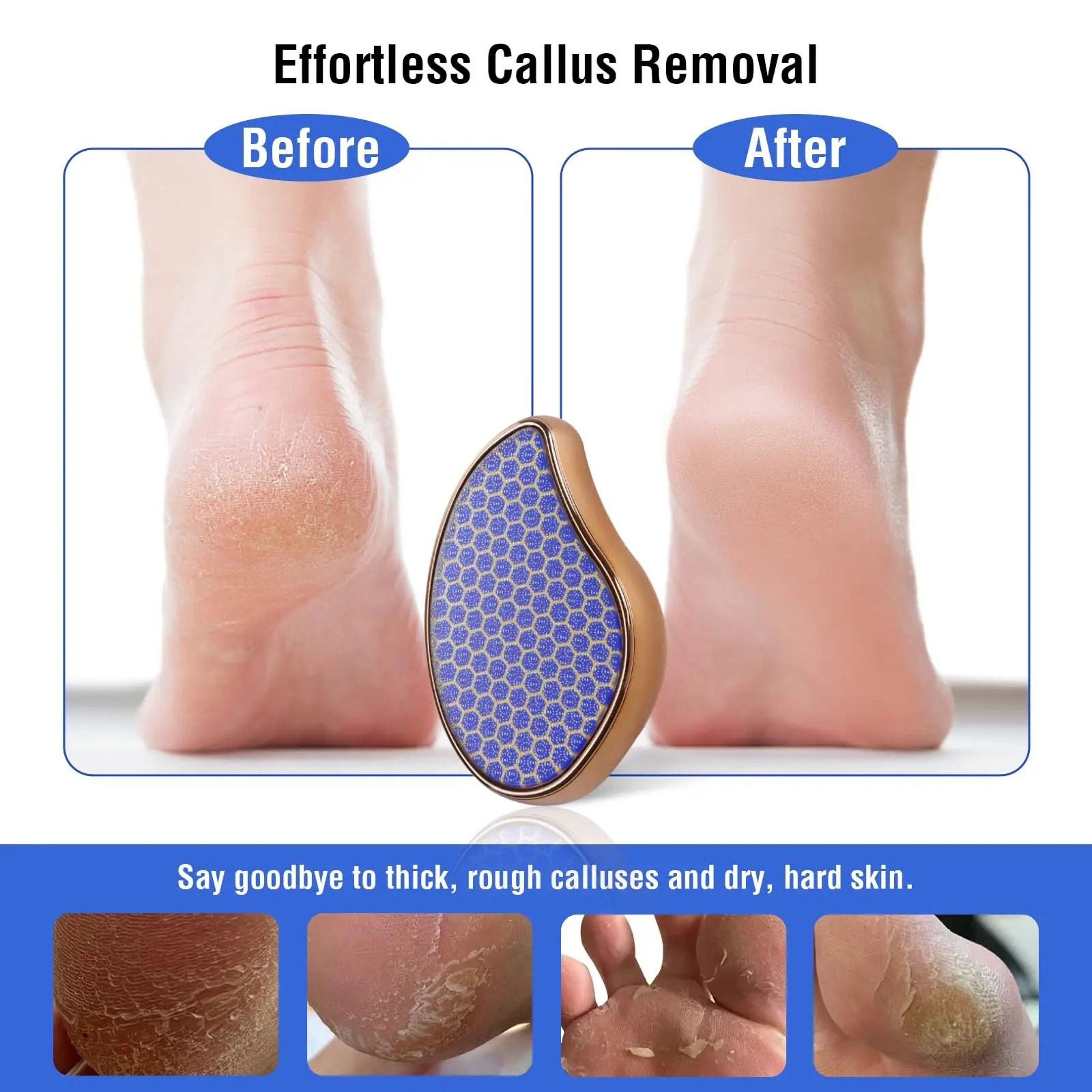 Nano Glass Heel Scraper For Foot Care And Dead Skin Removal 1