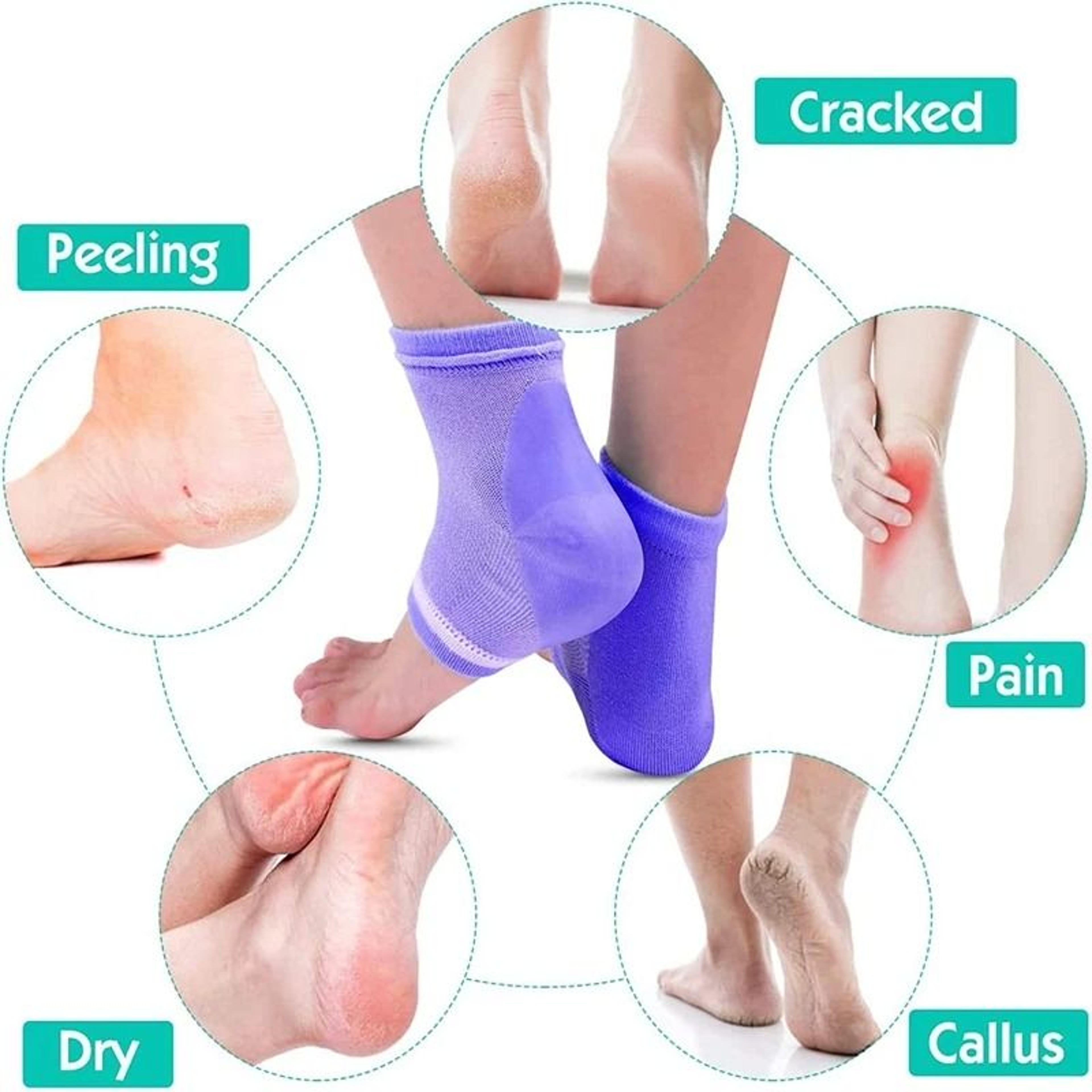 Hydrogel Infused Moisture Retention Heel Protectors 5
