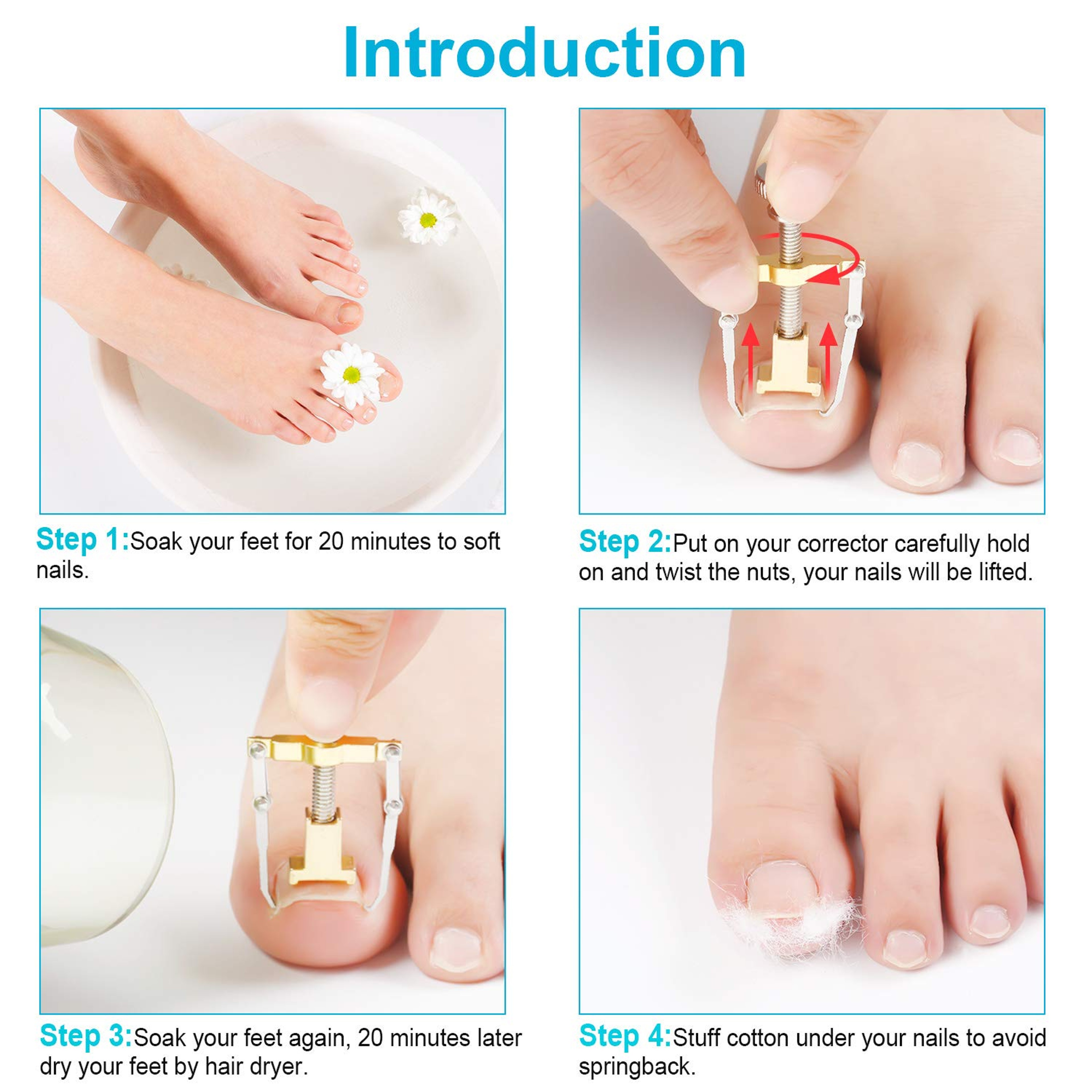Ingrown Toe Nail Fixer Device (6).jpg
