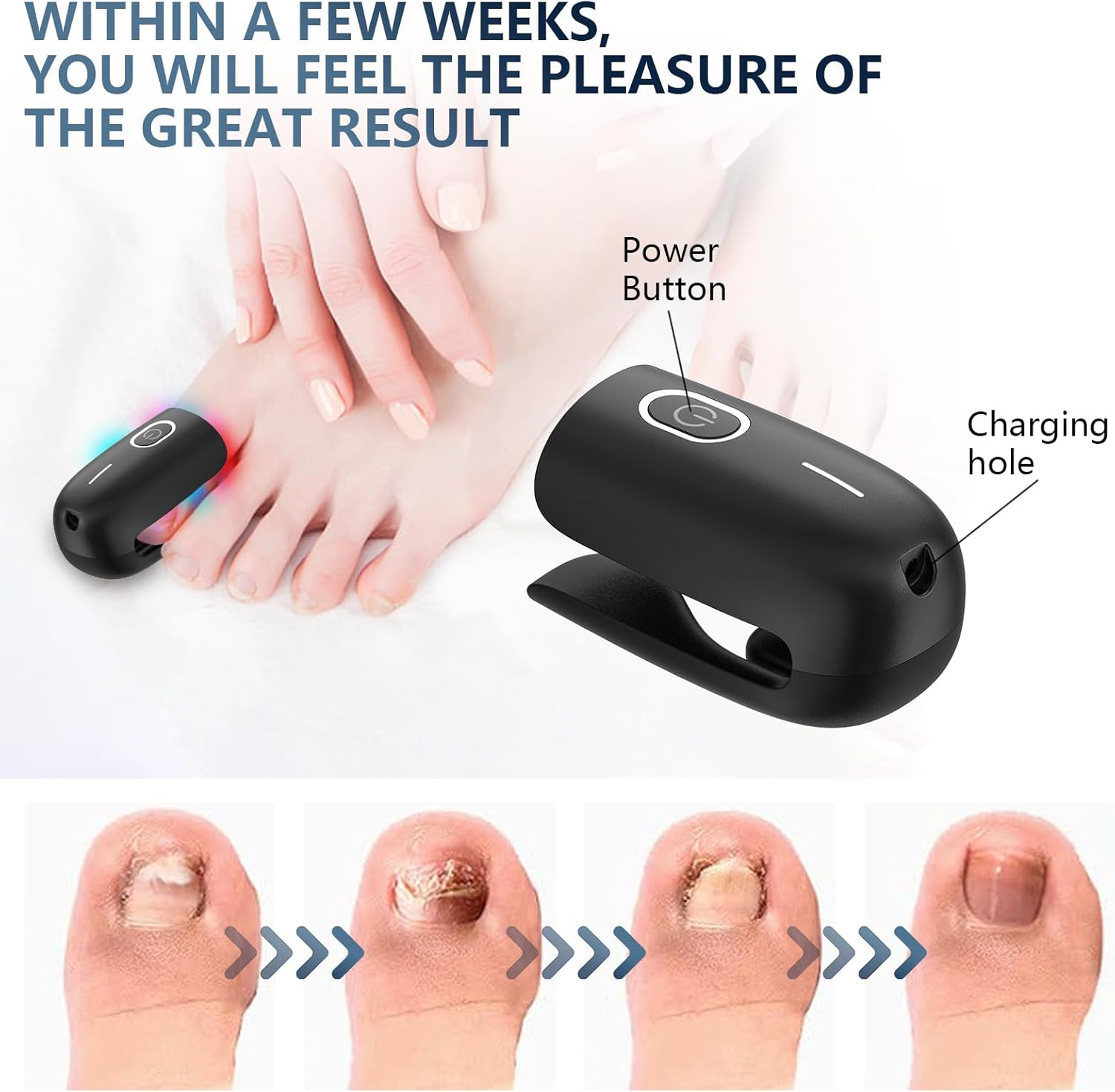 Nail Fungus Laser Device Super Pulsed Invisible Light Smart Remove and Repair Fungal Nail, Portable, Rechargeable – view 4